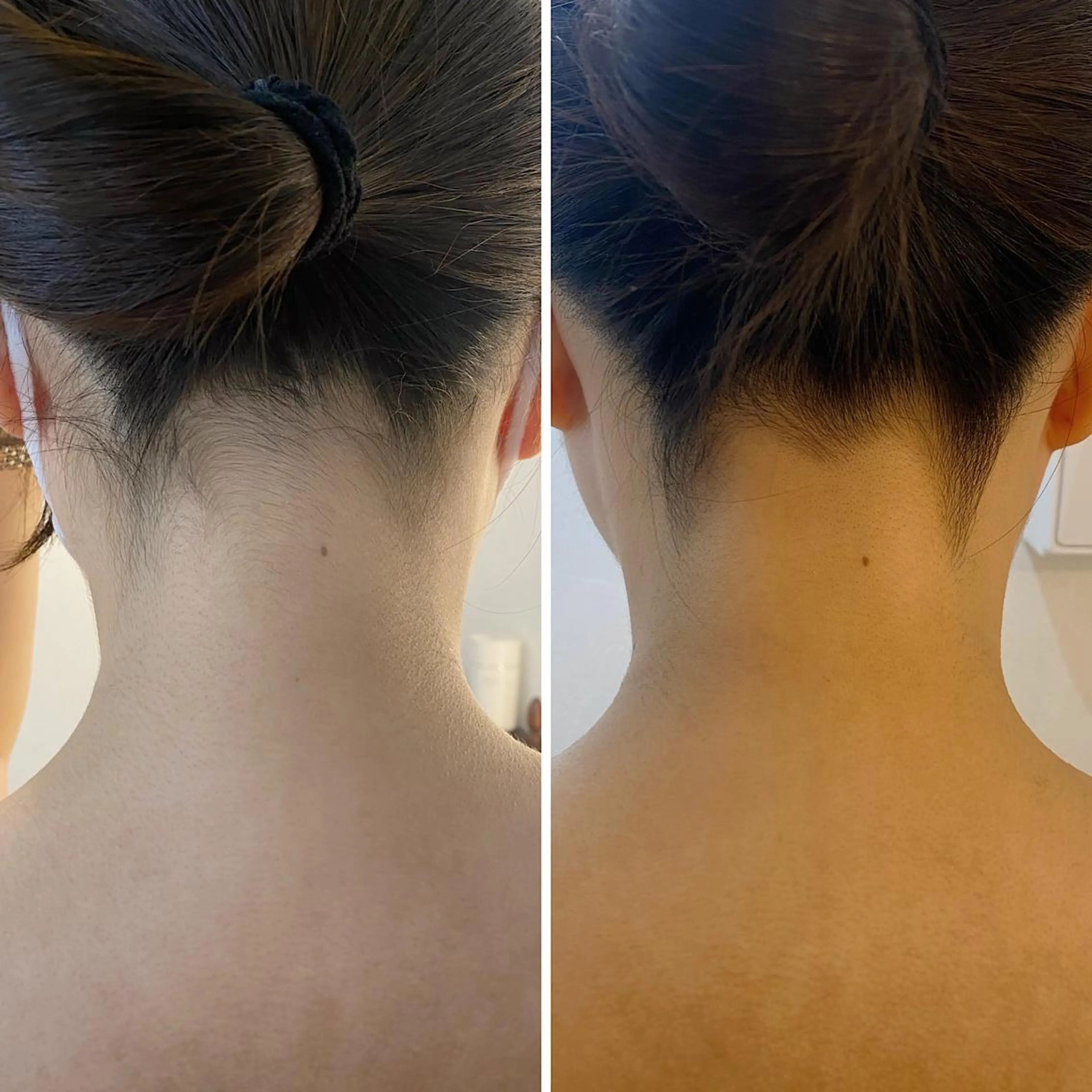 脱毛 うなじ脱毛/美肌脱毛 LABELのエステ・リラクイメージ