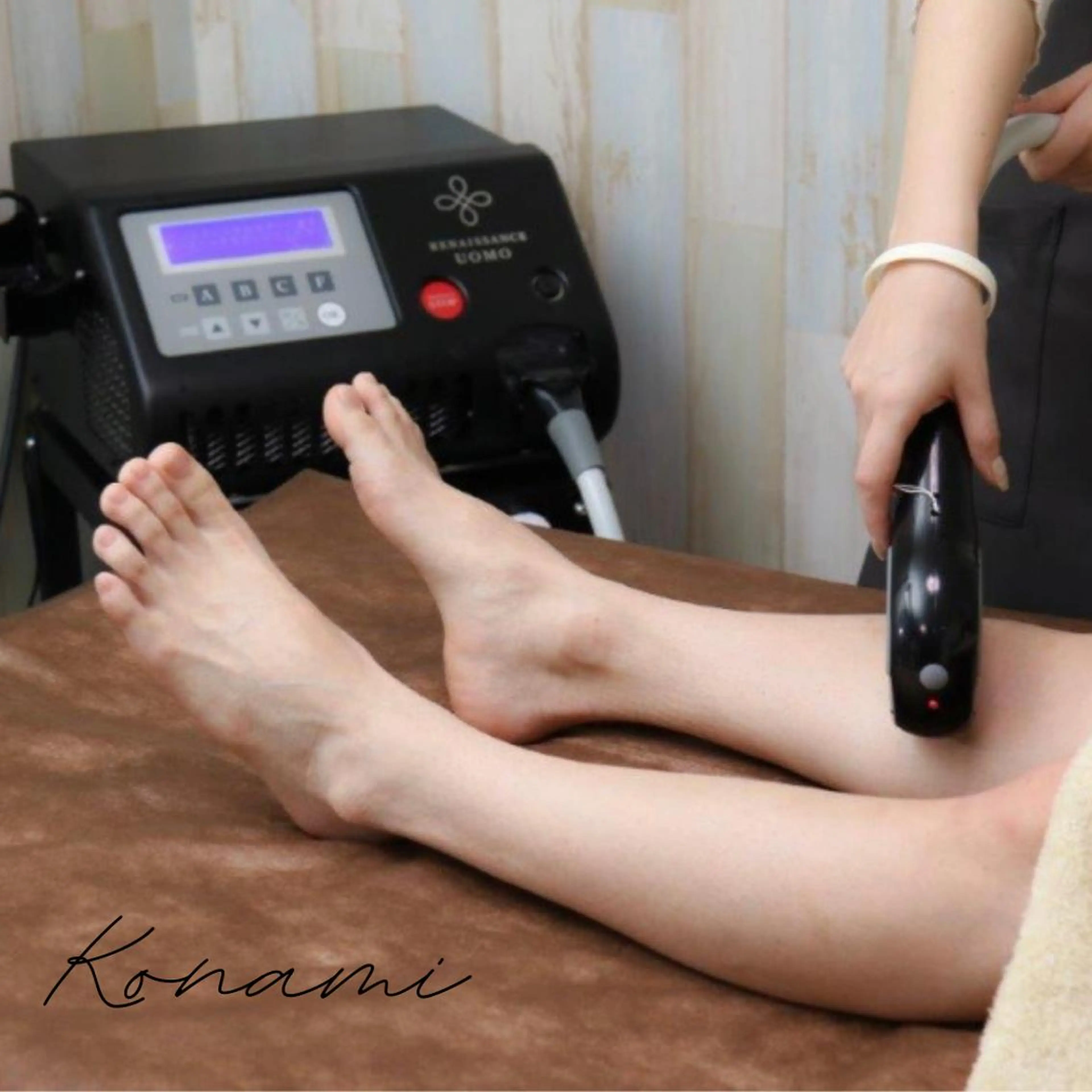 【光脱毛】全身（顔➕VIOT込）の写真