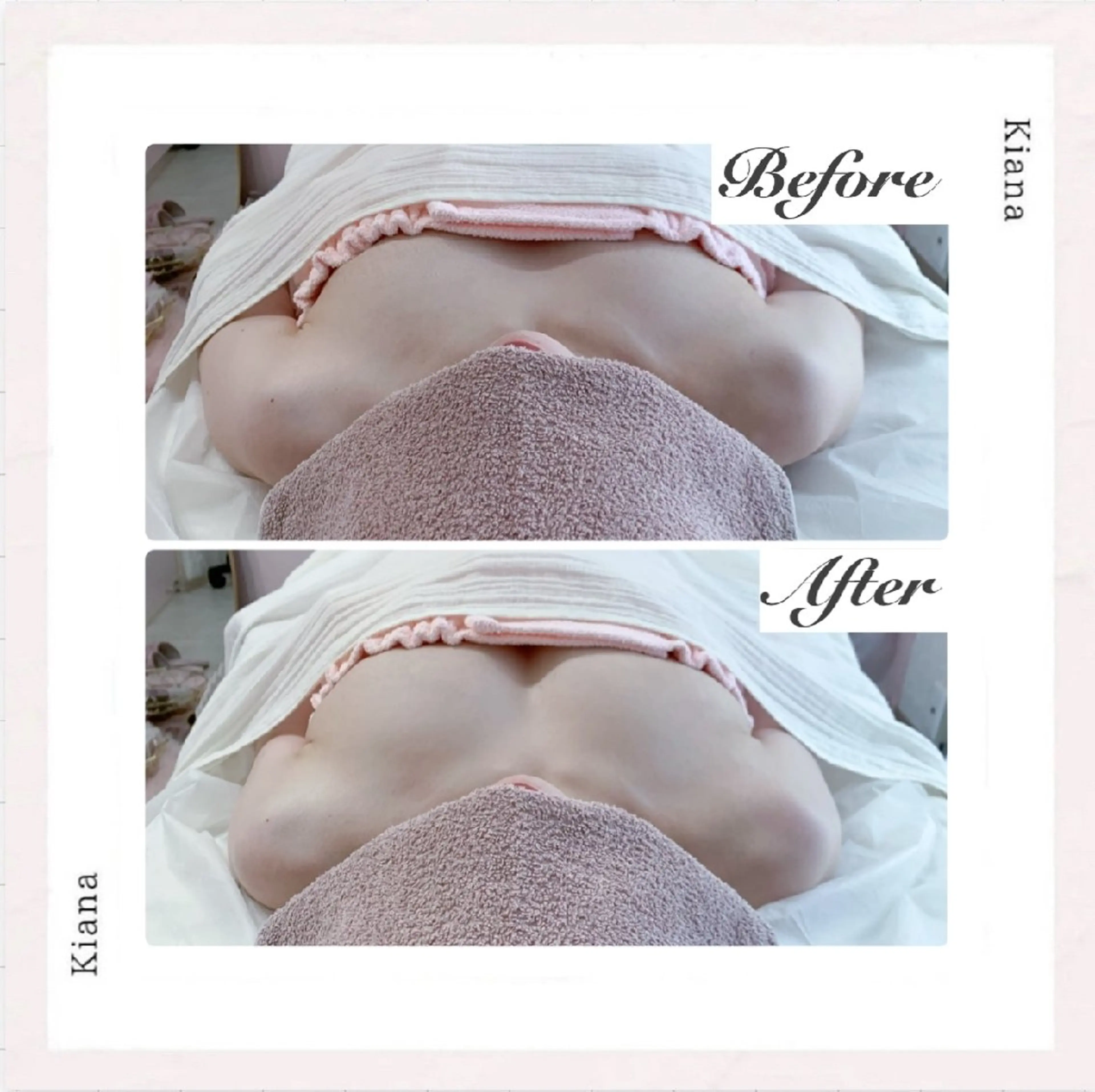 エステ リラク 【バスト専門店 】 Kiana のエステ・リラクイメージ