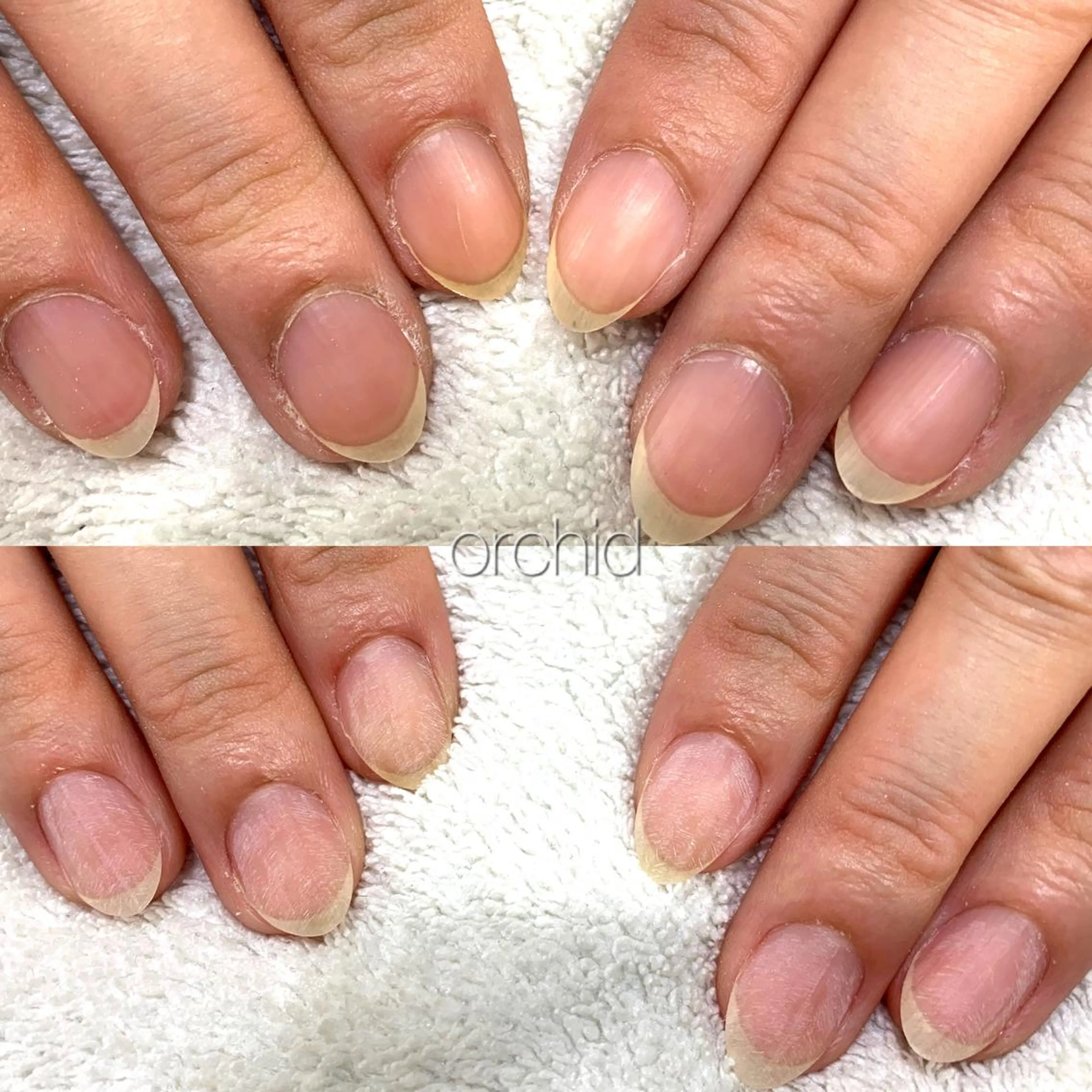 ネイル ハンドネイル フットネイル ハンドケア orchid ♡オーキッドのネイルデザイン