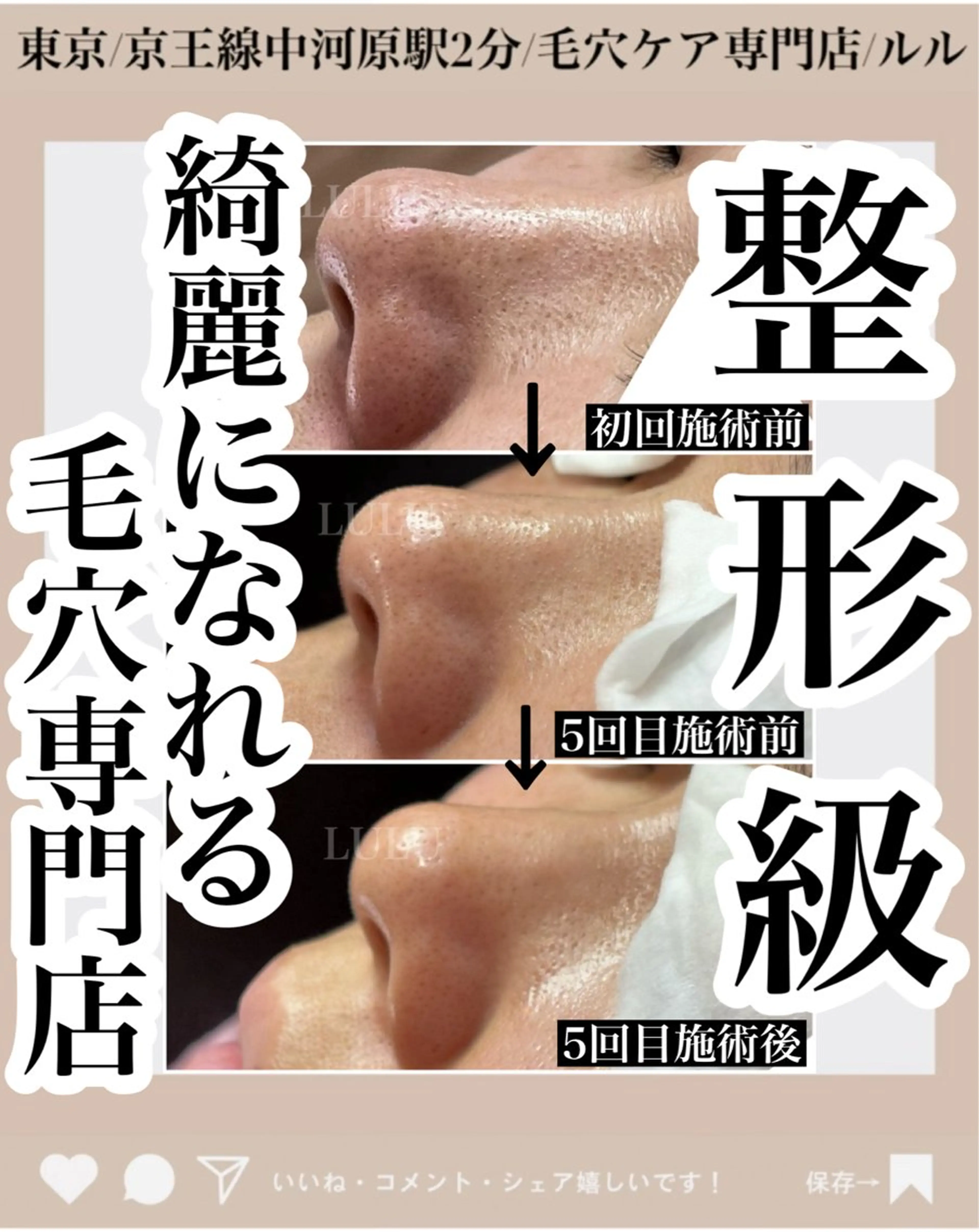 LULU所属・LULU ルルのエステ・リラクイメージ