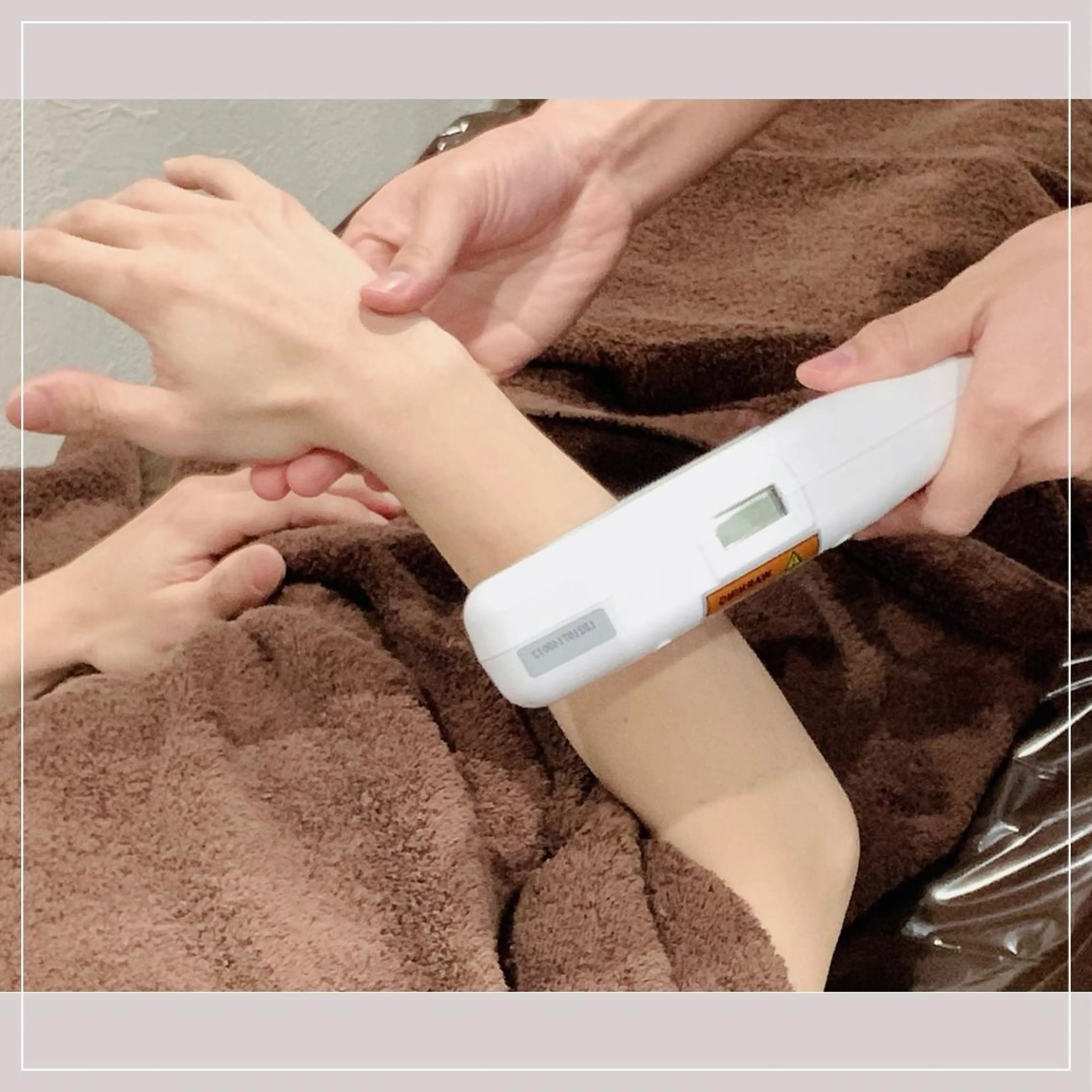 メンズ腕脱毛（ひじ上＋ひじ下）の写真