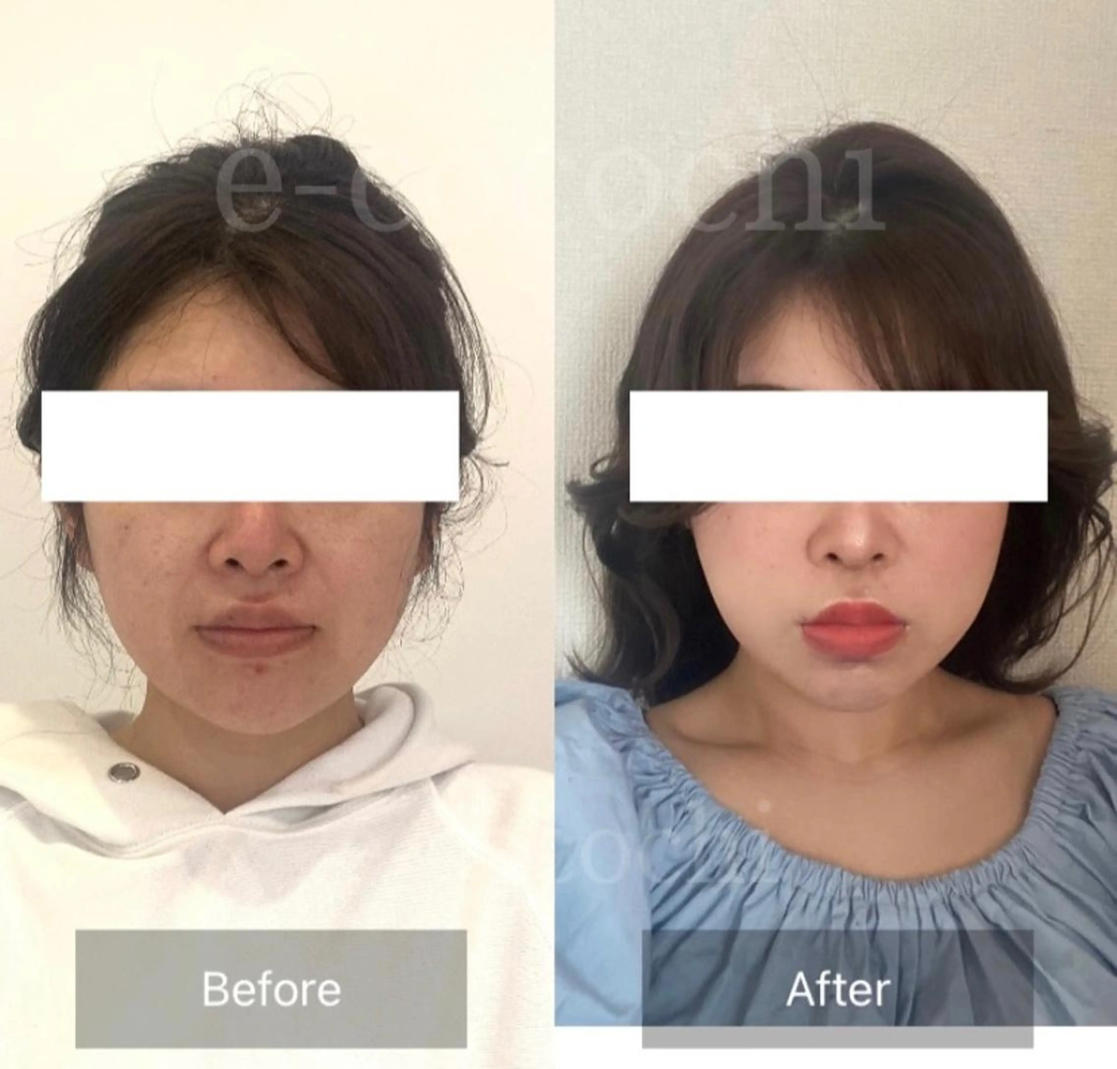 エステ リラク 小顔と ヘッドスパのお店のエステ・リラクイメージ