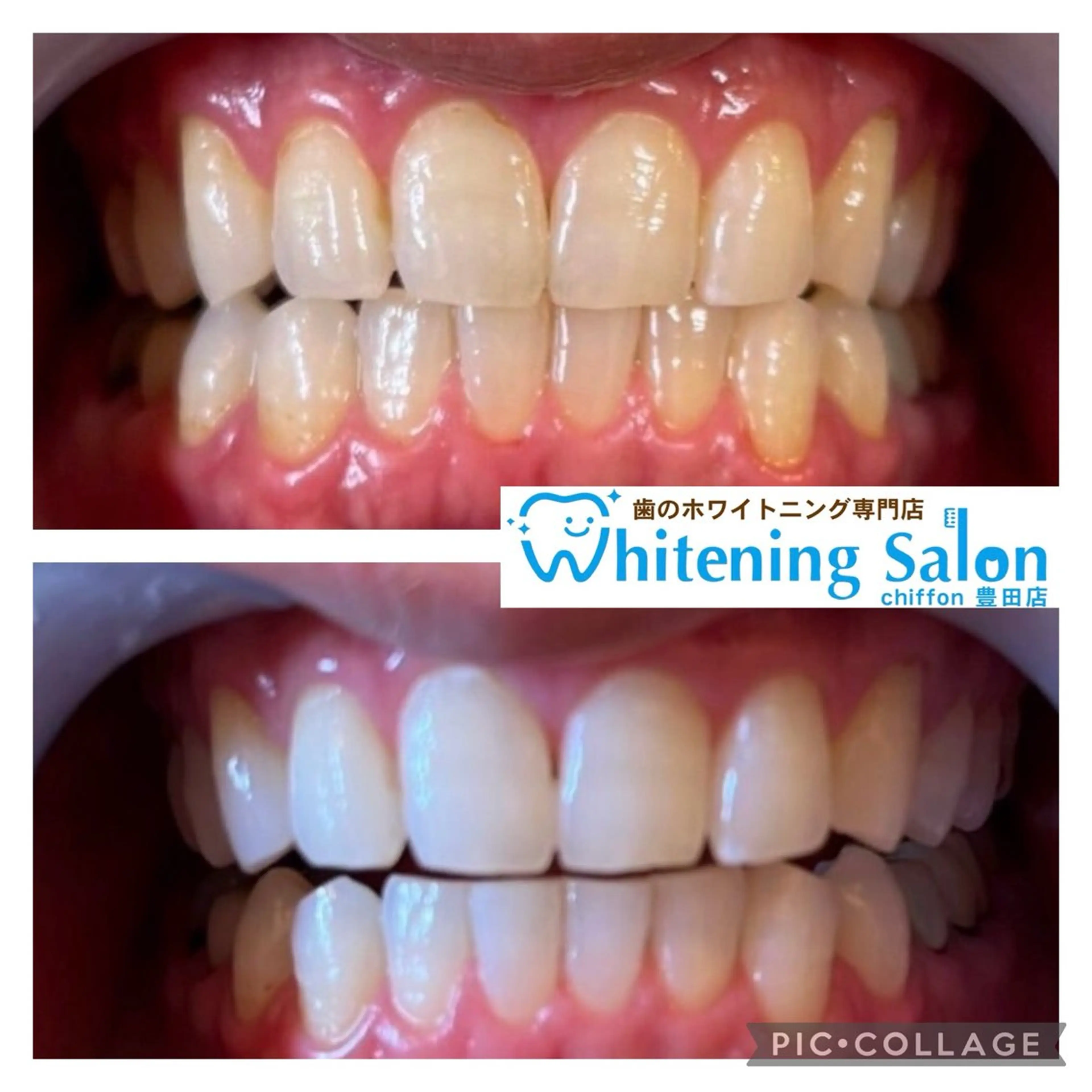 エステ ホワイトニングサロンシフォン豊田店所属・ホワイトニングサロン シフォン豊田店のその他イメージ