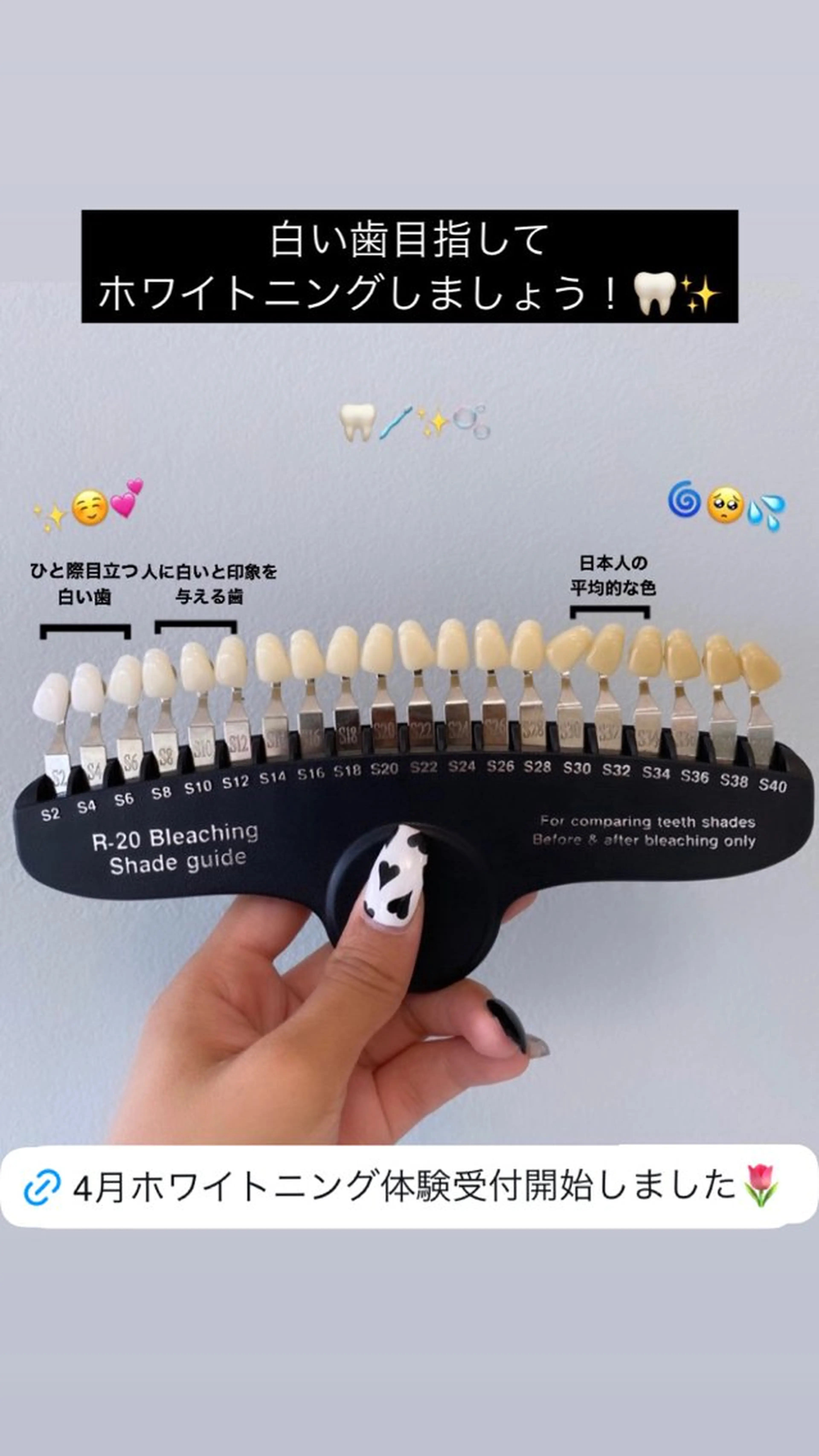 その他 エクシアホワイトニング草津店所属・nanami -ホワイトニングのその他イメージ