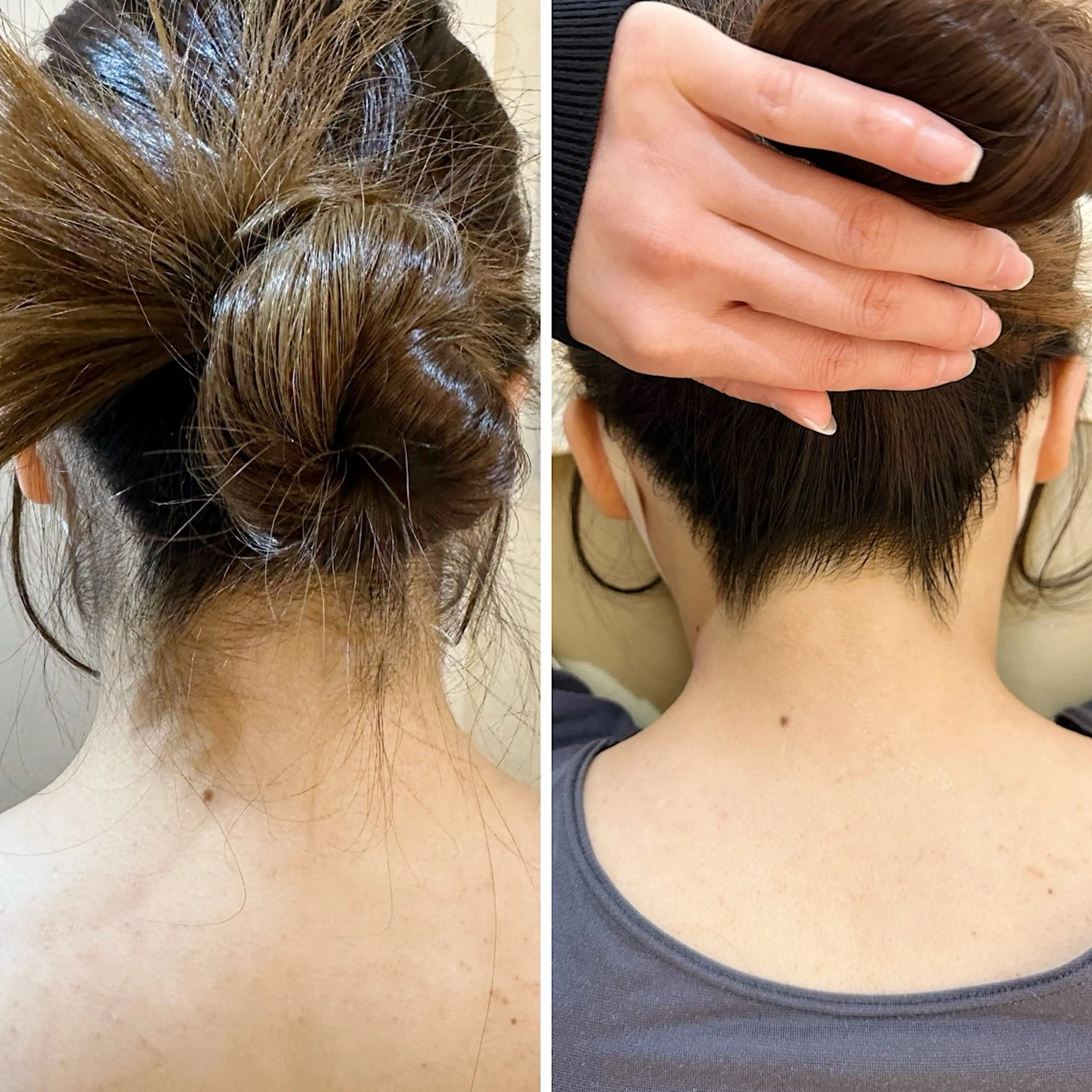 脱毛 うなじ脱毛/美肌脱毛 LABELのエステ・リラクイメージ