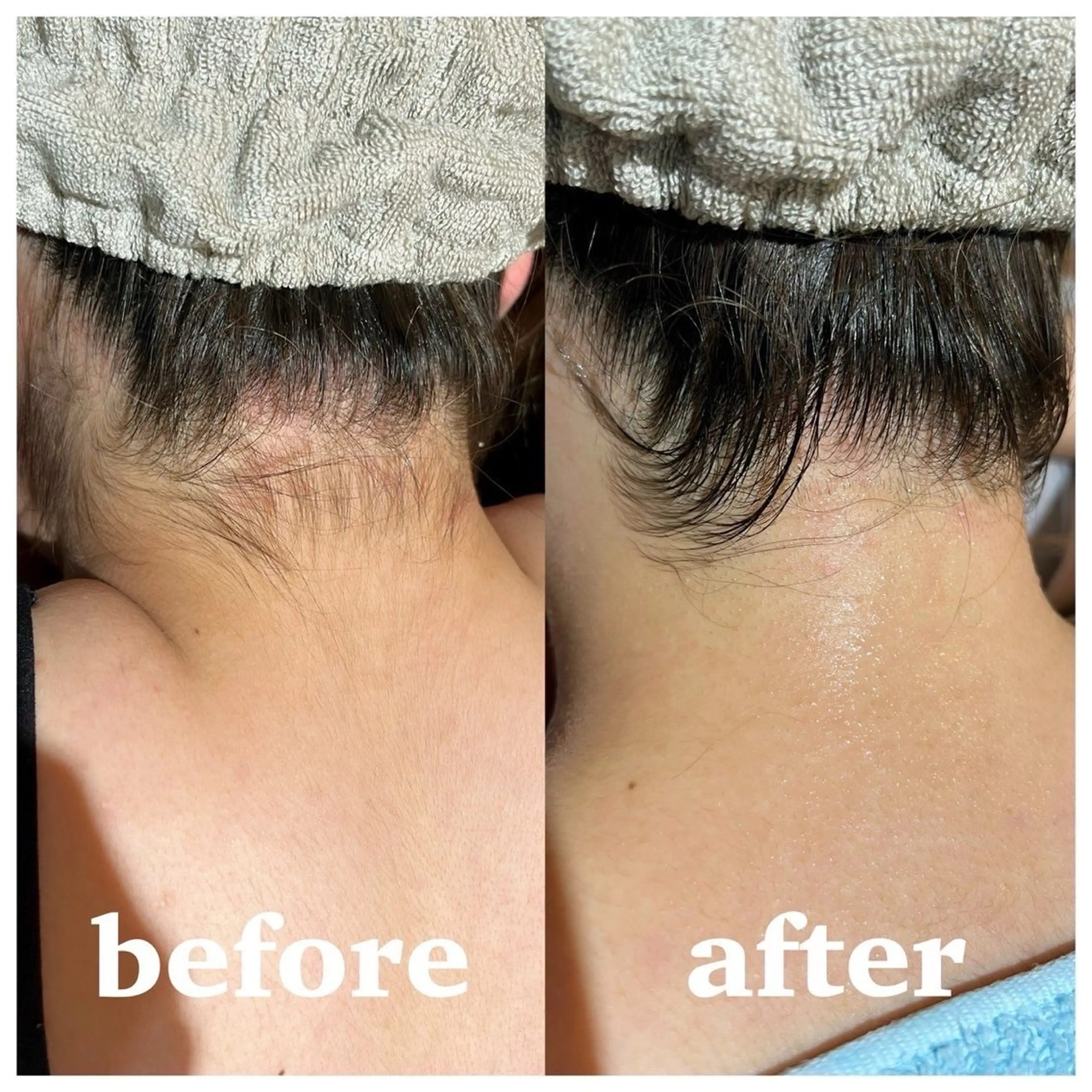 ゆいまーるはうすソラトウミ所属・ゆいまーるはうす 脱毛南城市のエステ・リラクイメージ