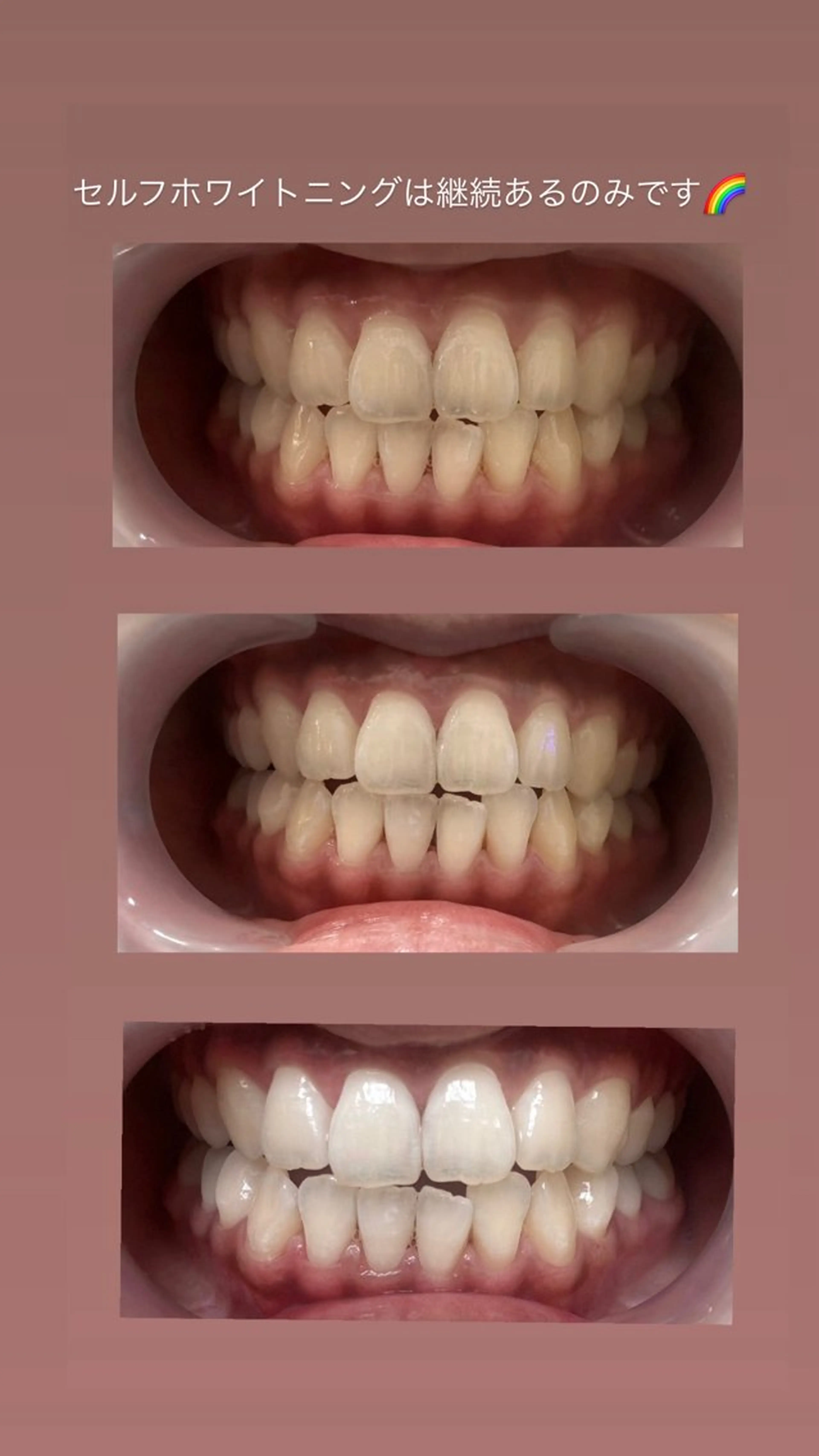 Vistar nail所属・黒崎店 MOMOKAのネイルデザイン