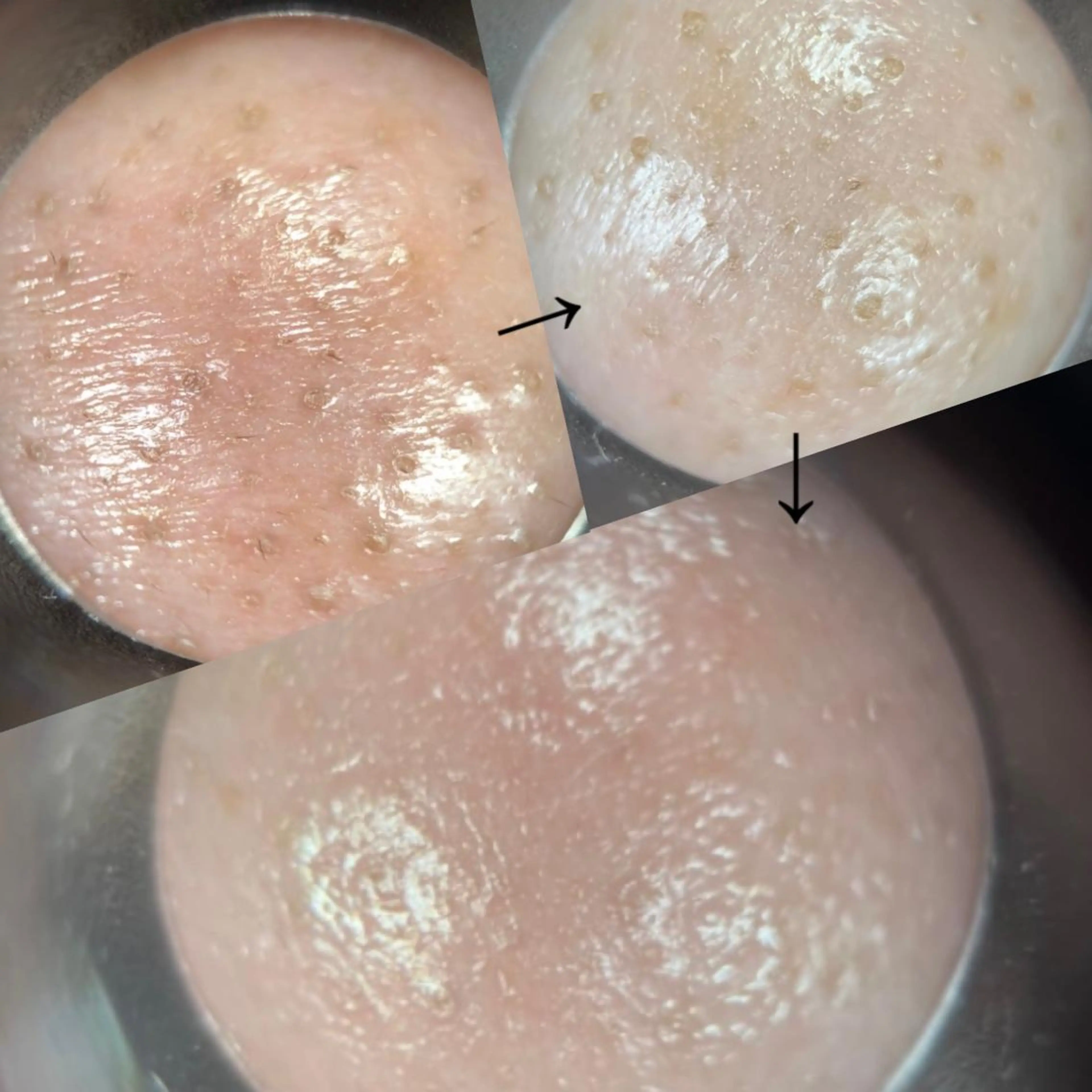 メナードフェイシャルサロン　福山東手城所属・耳ツボ/エステ/ CHIHIROのエステ・リラクイメージ