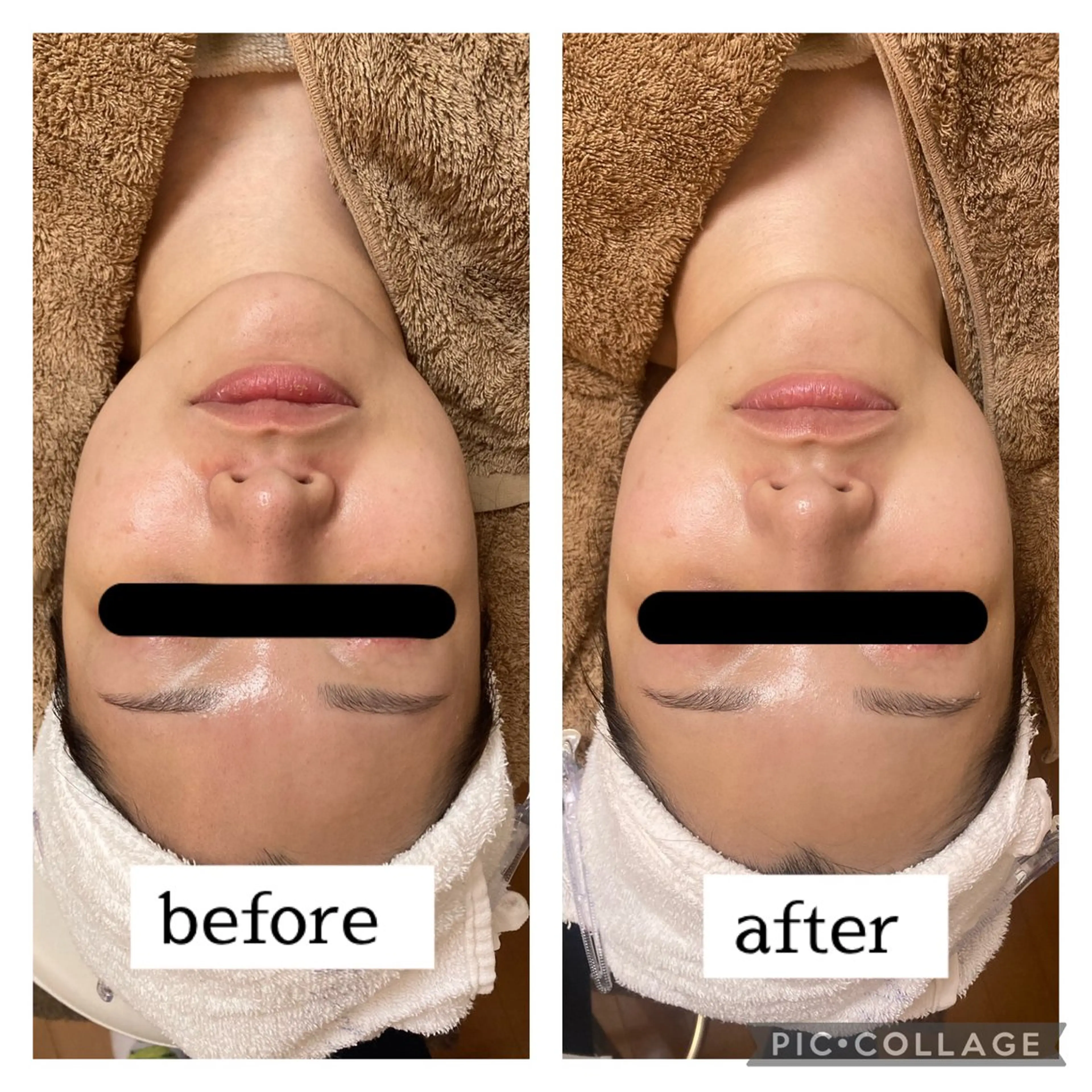 肌悩み改善 〜エステサロン〜のエステ・リラクイメージ