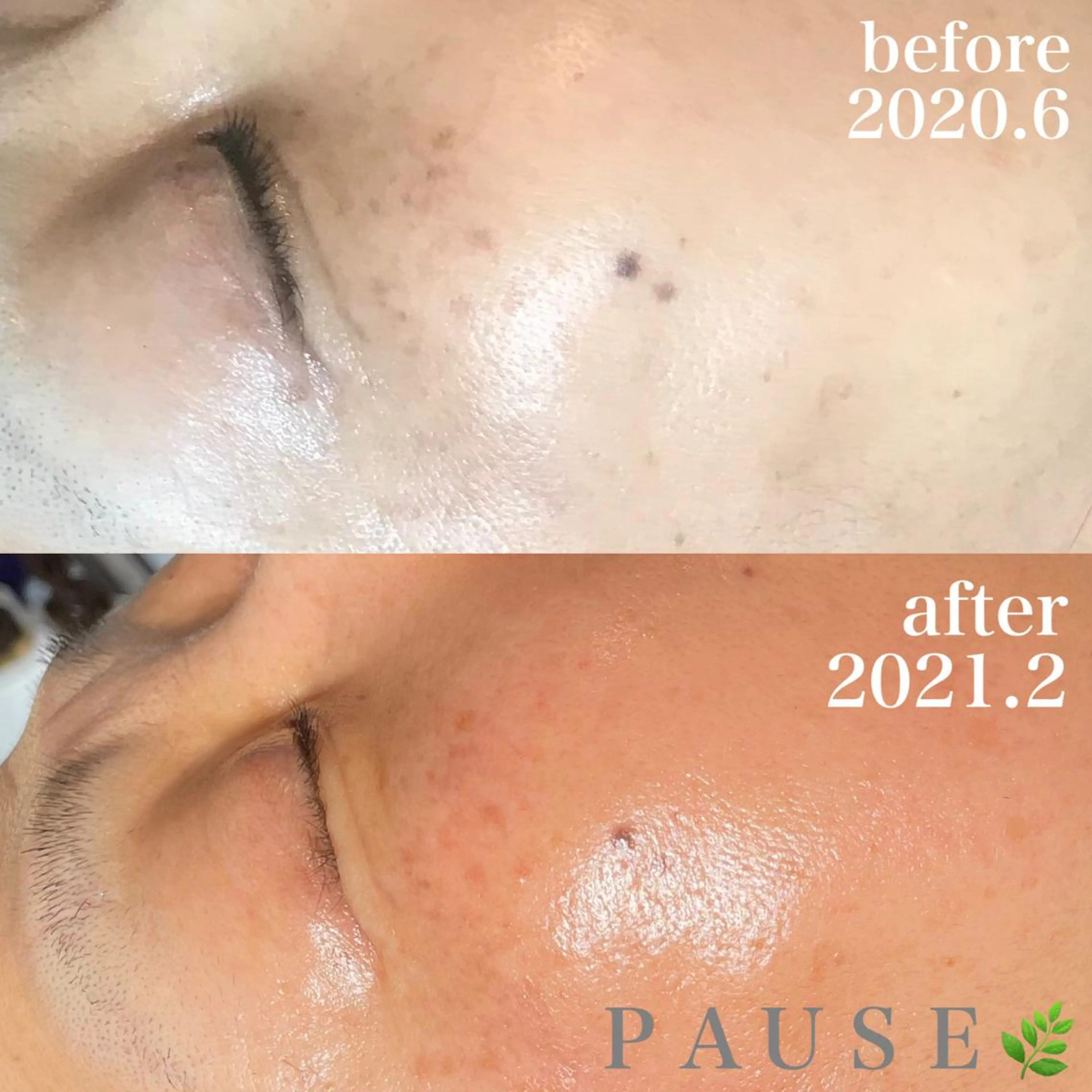 エステ 浜野 恵美のエステ・リラクイメージ