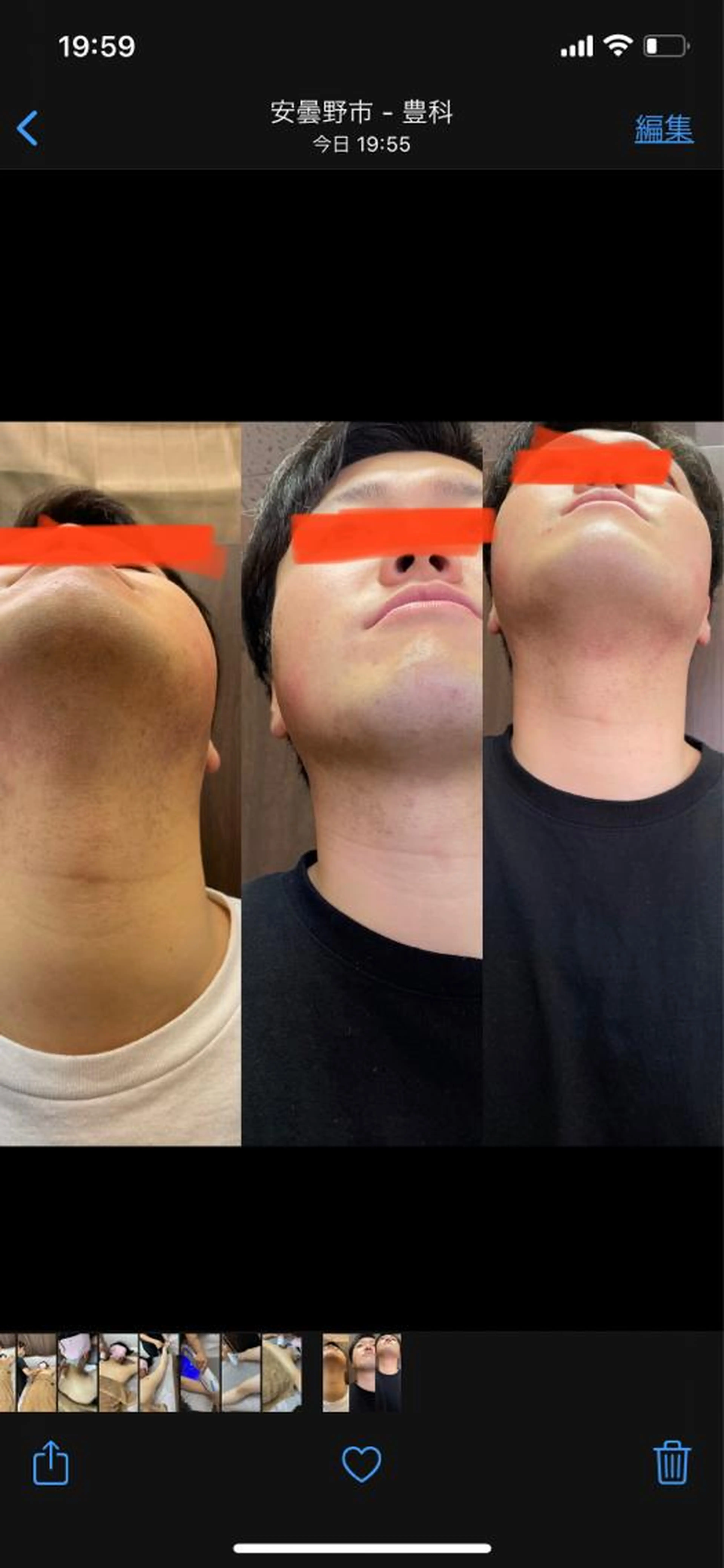 ヒゲ脱毛！初回980円！痛みの感じにくい脱毛！髭剃りの煩わしさから解放されませんか？の写真