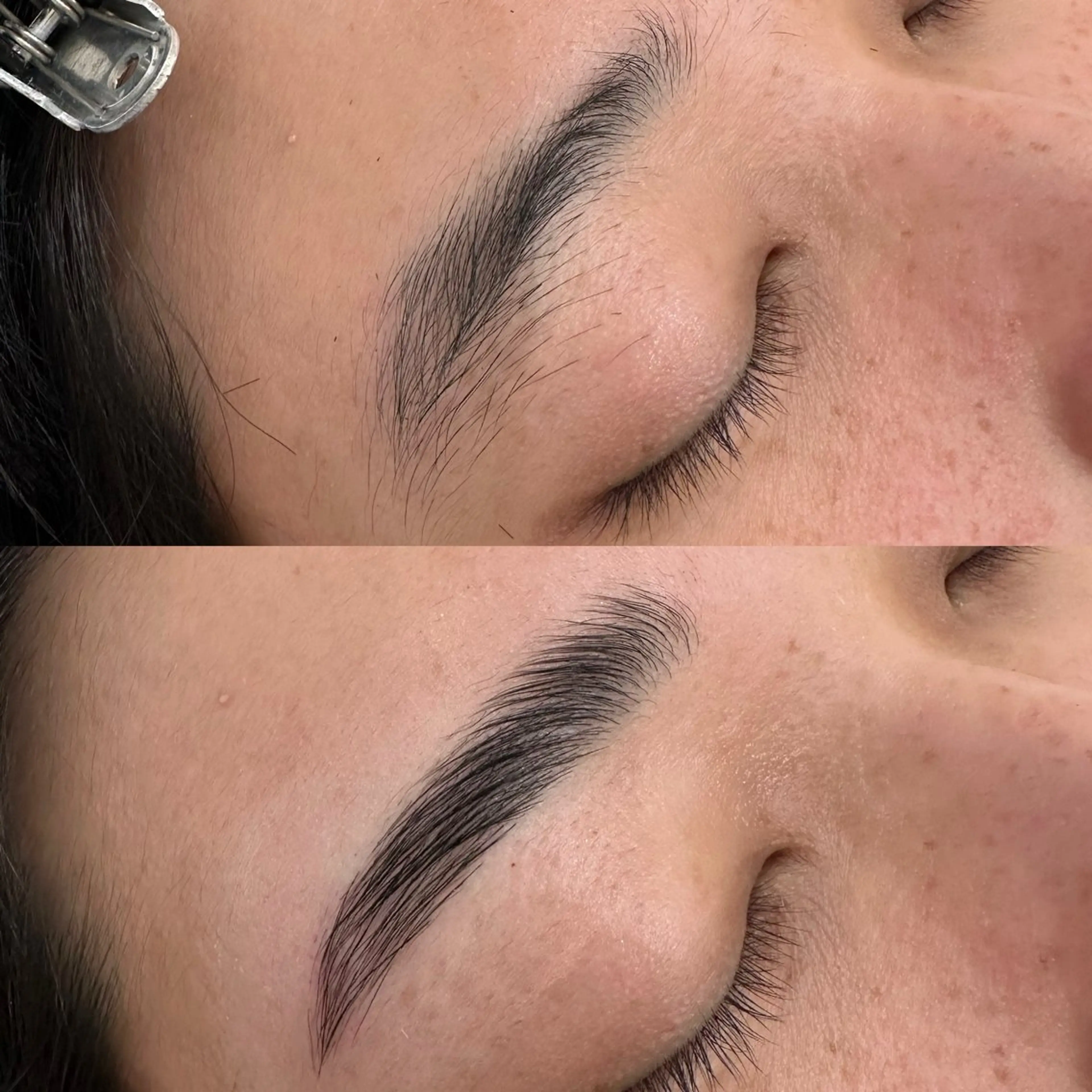 ブロウリフトの写真