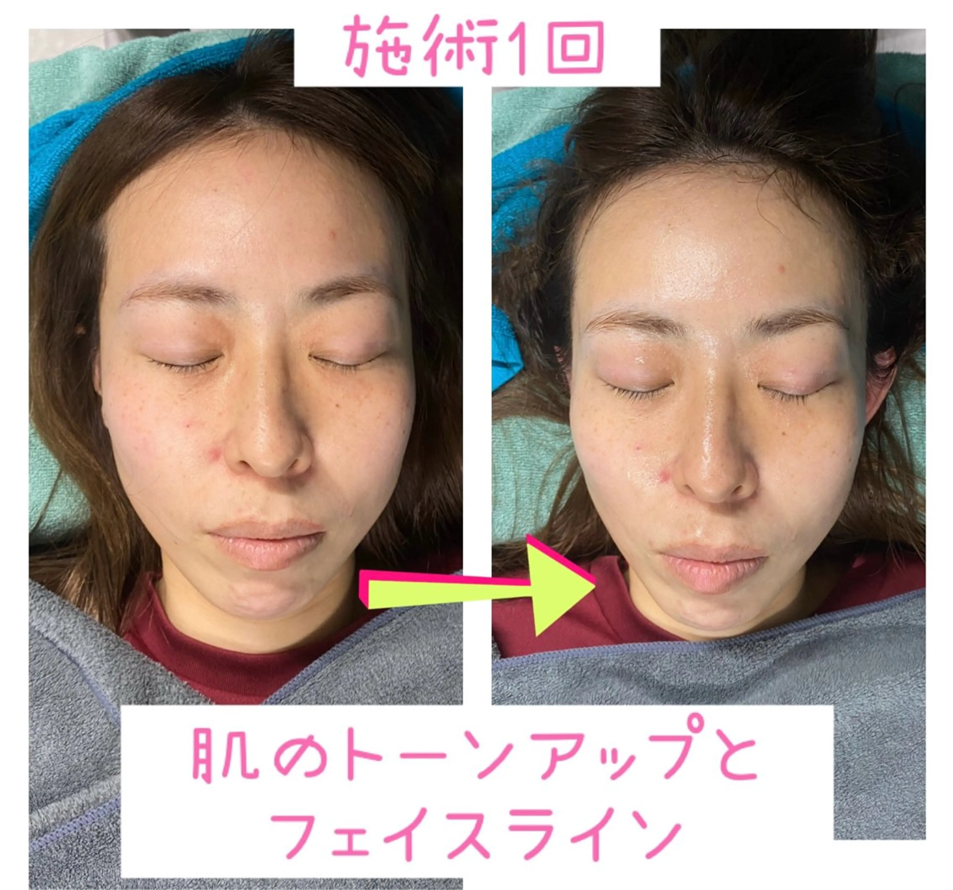 エステ リラク リラクゼーション 空 -sora-のエステ・リラクイメージ