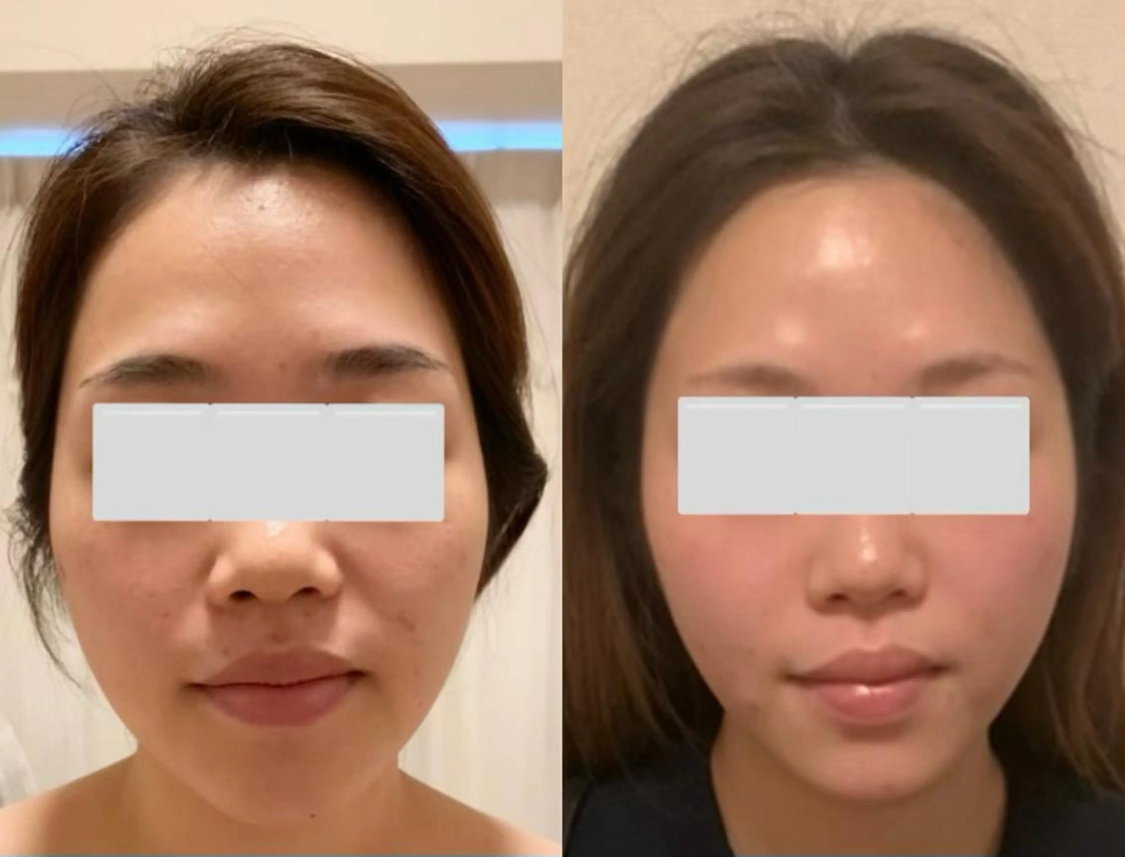 a  room salonのエステ・リラクイメージ