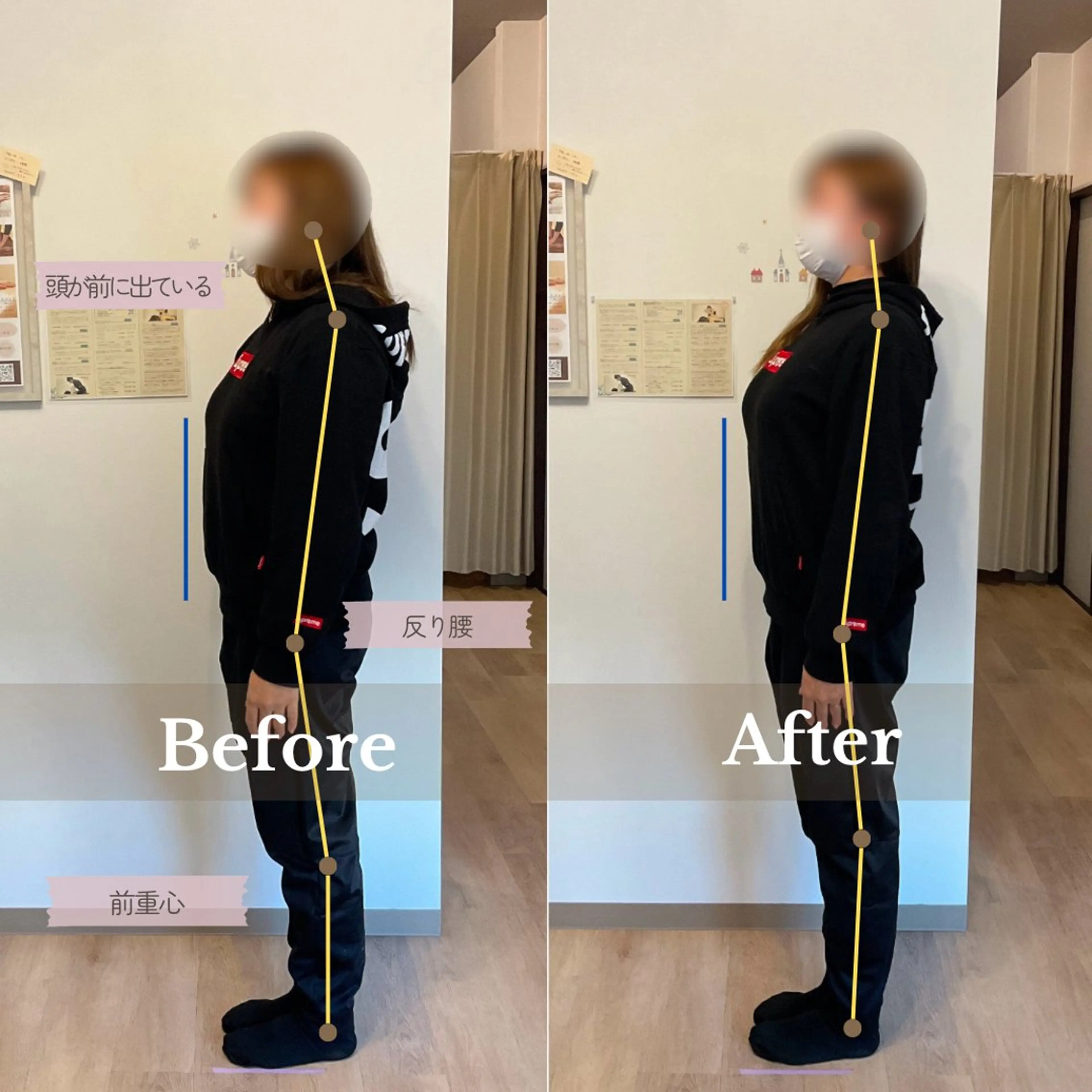 【頭痛・肩こり・腰痛ケアに◎】姿勢診断&全身整体 60分の写真