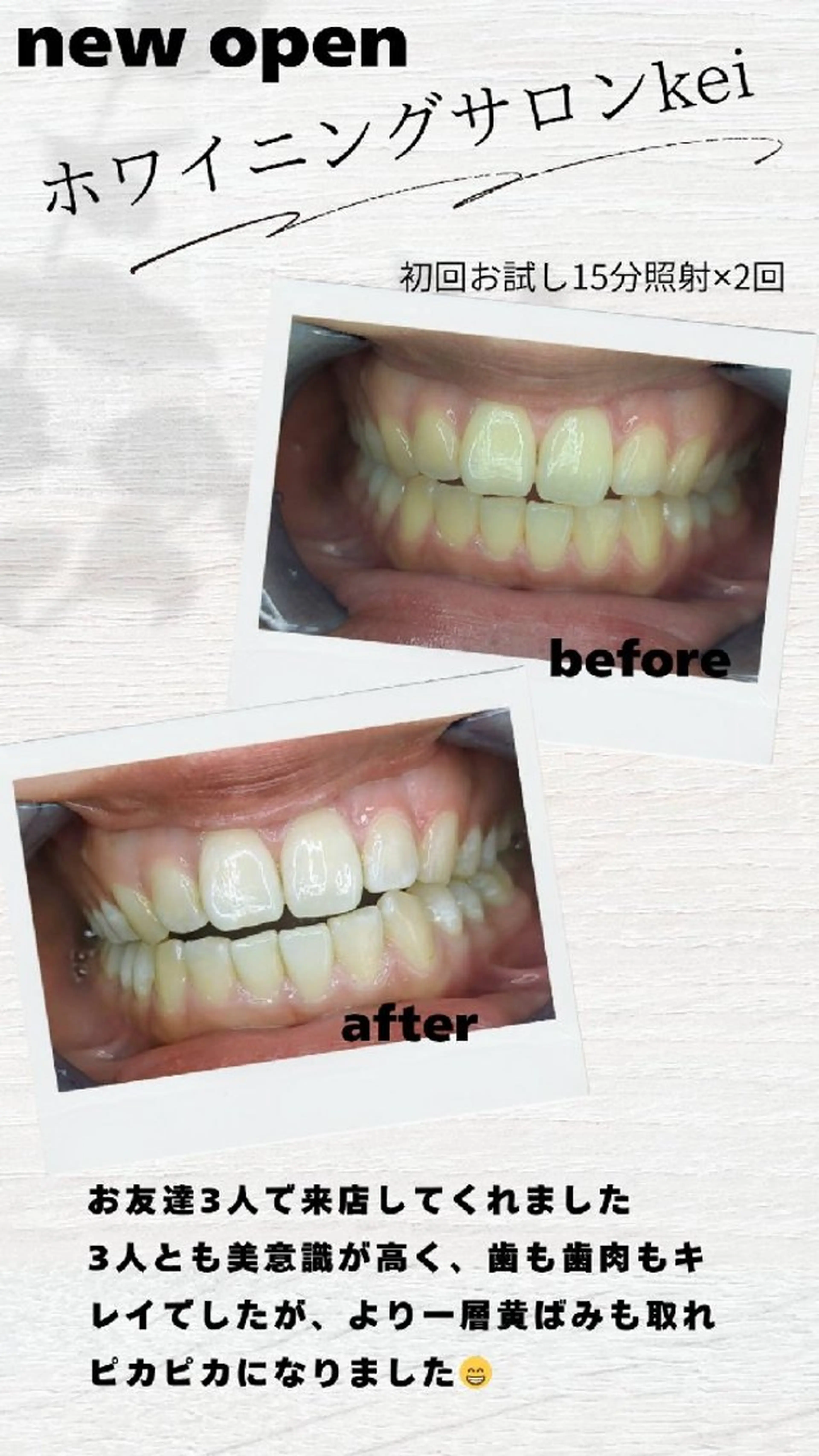 初回お試し15分×2照射の写真