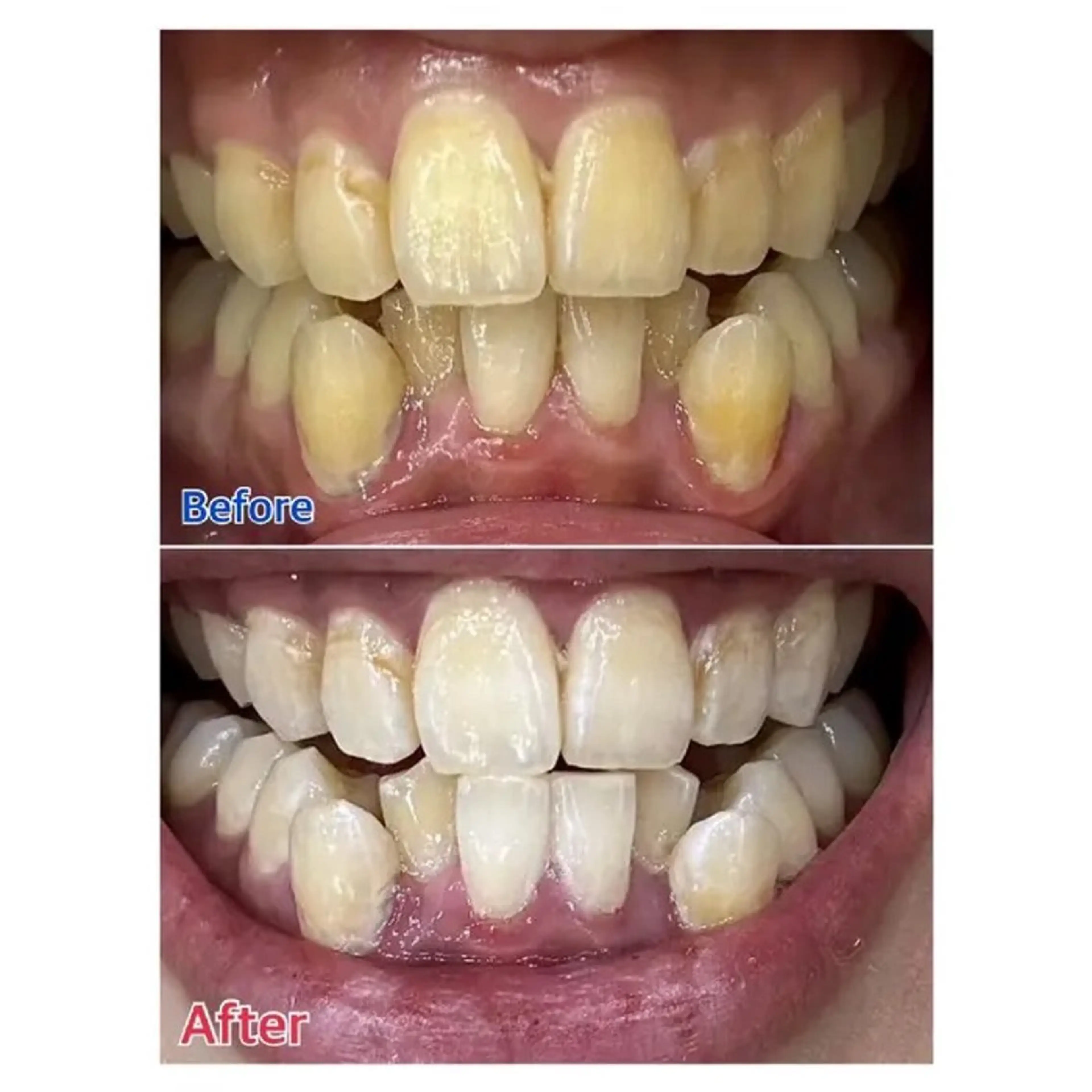 M渋谷店所属・Ｍ渋谷 ホワイトニングのエステ・リラクイメージ