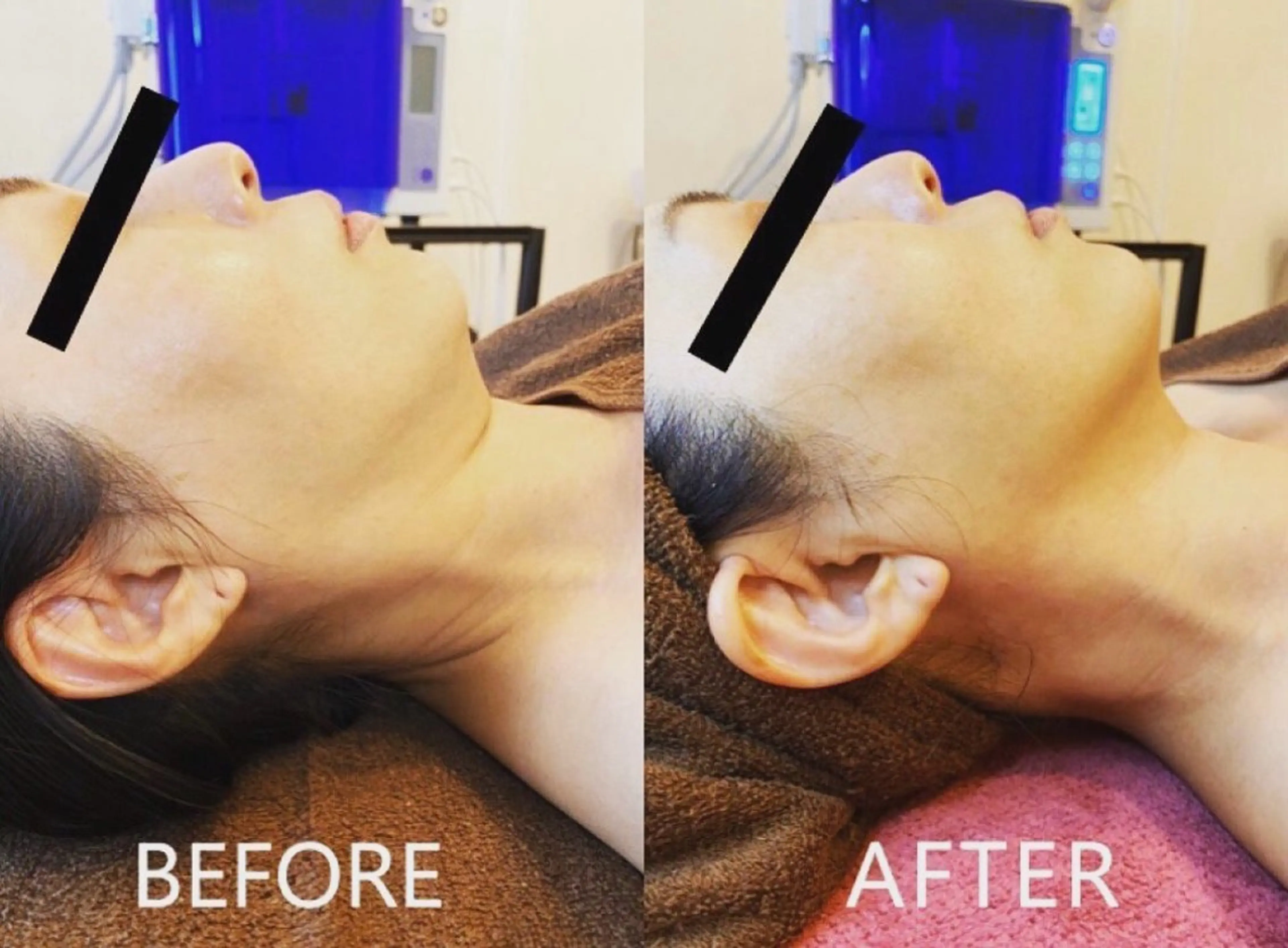 エステ 美肌フェイシャル・美肌脱毛 Di cuore所属・美肌専門 Di  cuoreのエステ・リラクイメージ