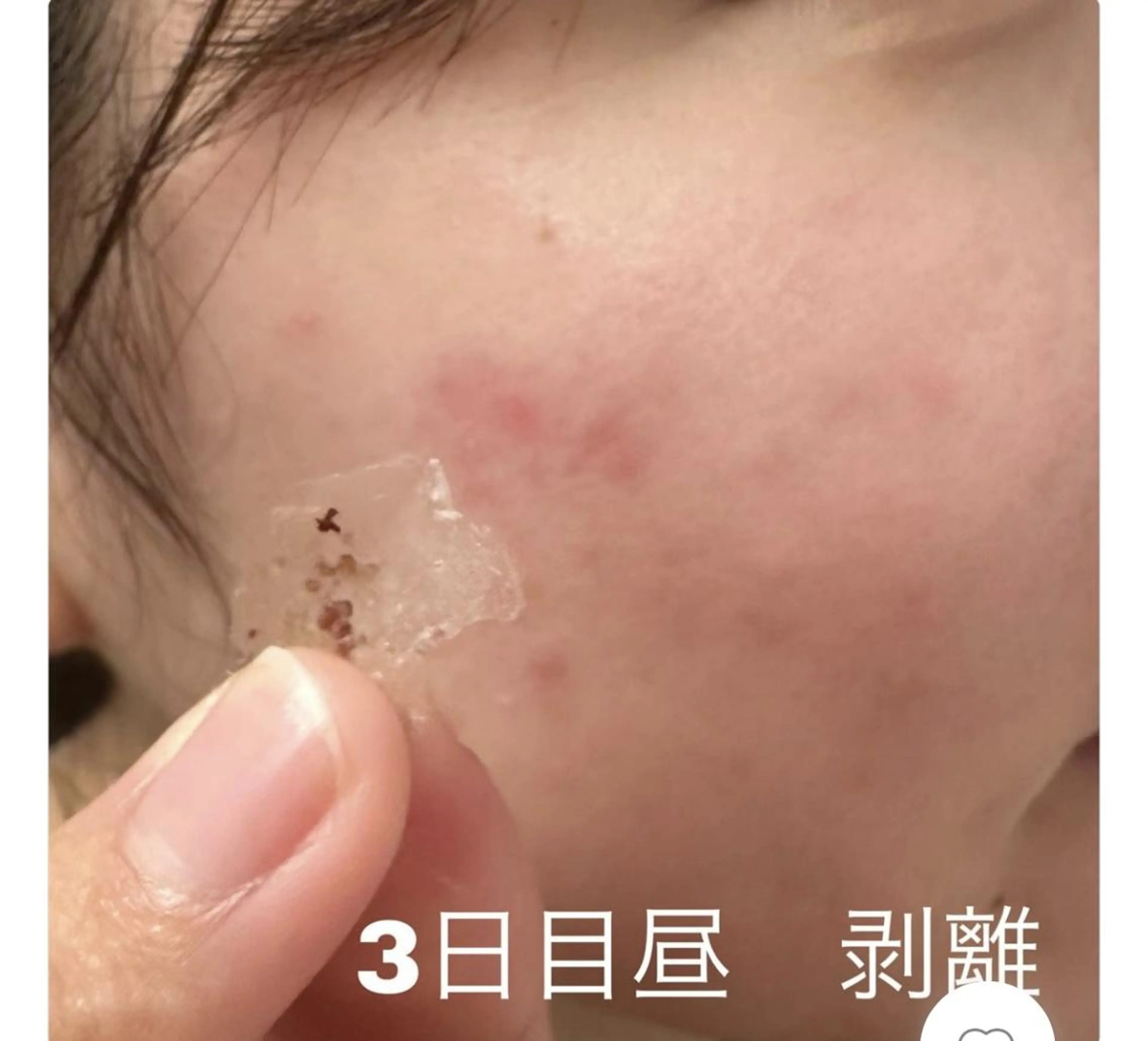 エステ レイビス 渋谷店のエステ・リラクイメージ