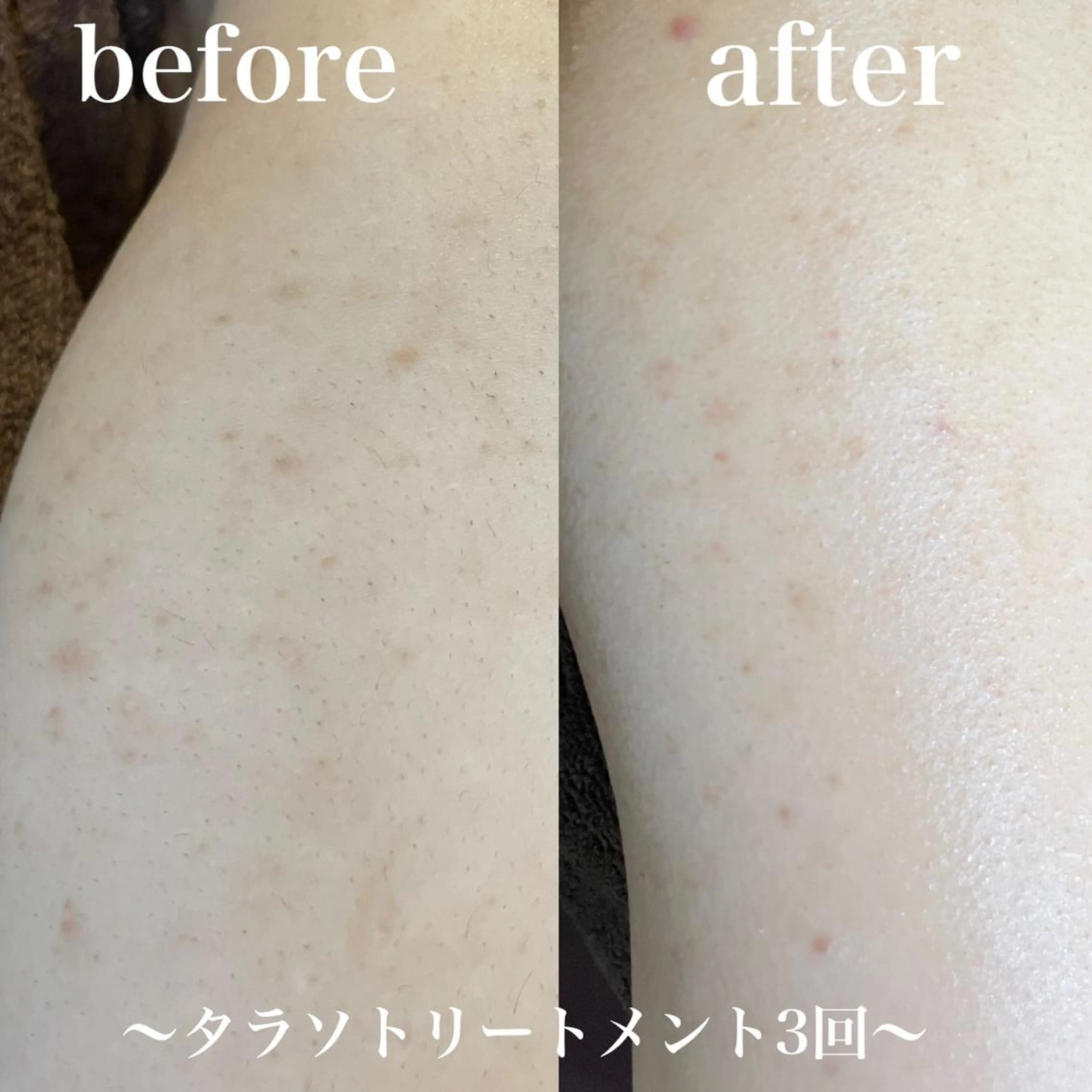 エステ 浜野 恵美のエステ・リラクイメージ