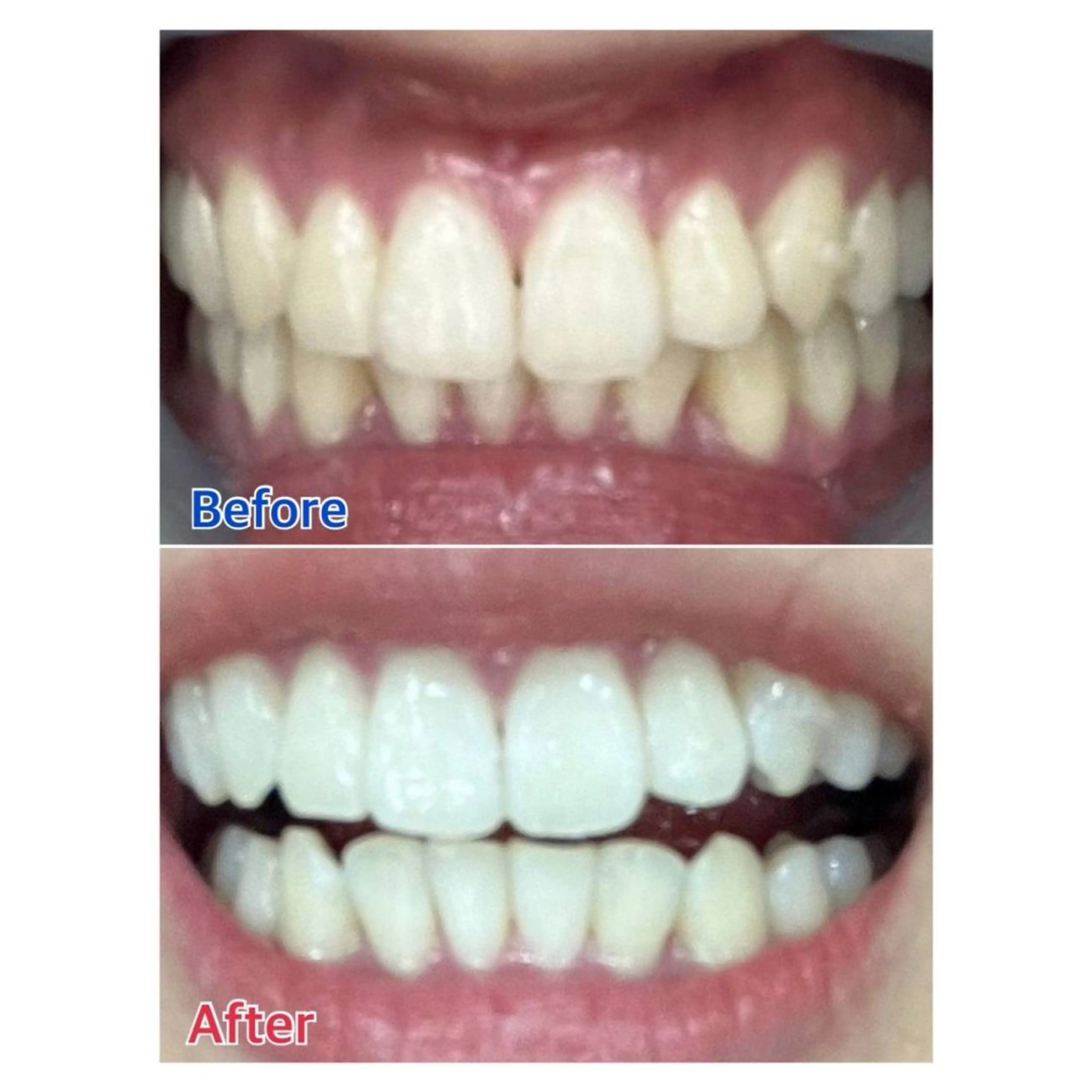 MBEAUTYSALON 千葉店・京成大久保所属・Melty 輝のその他イメージ