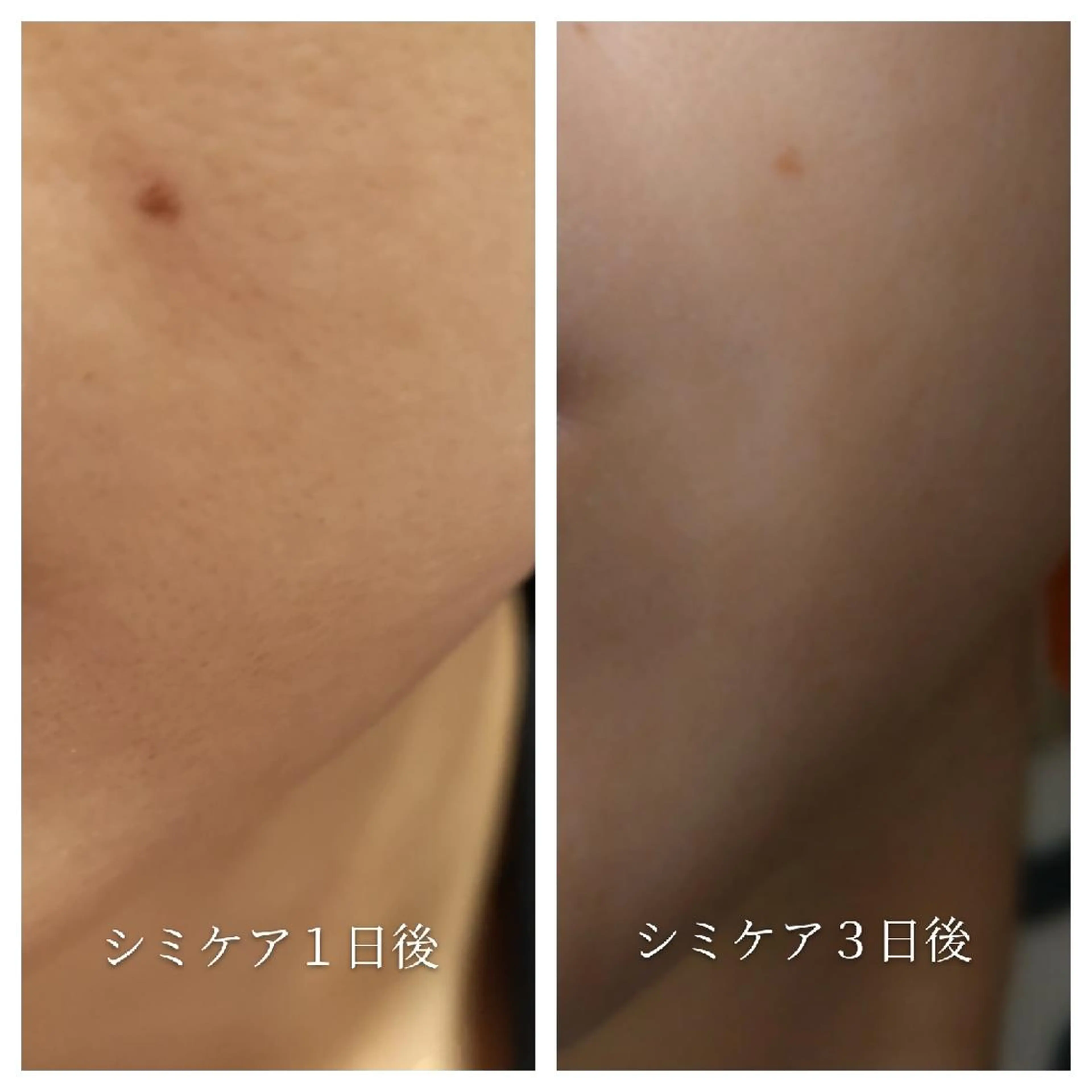 🅖🅤🅩🅔🅛 salonのエステ・リラクイメージ