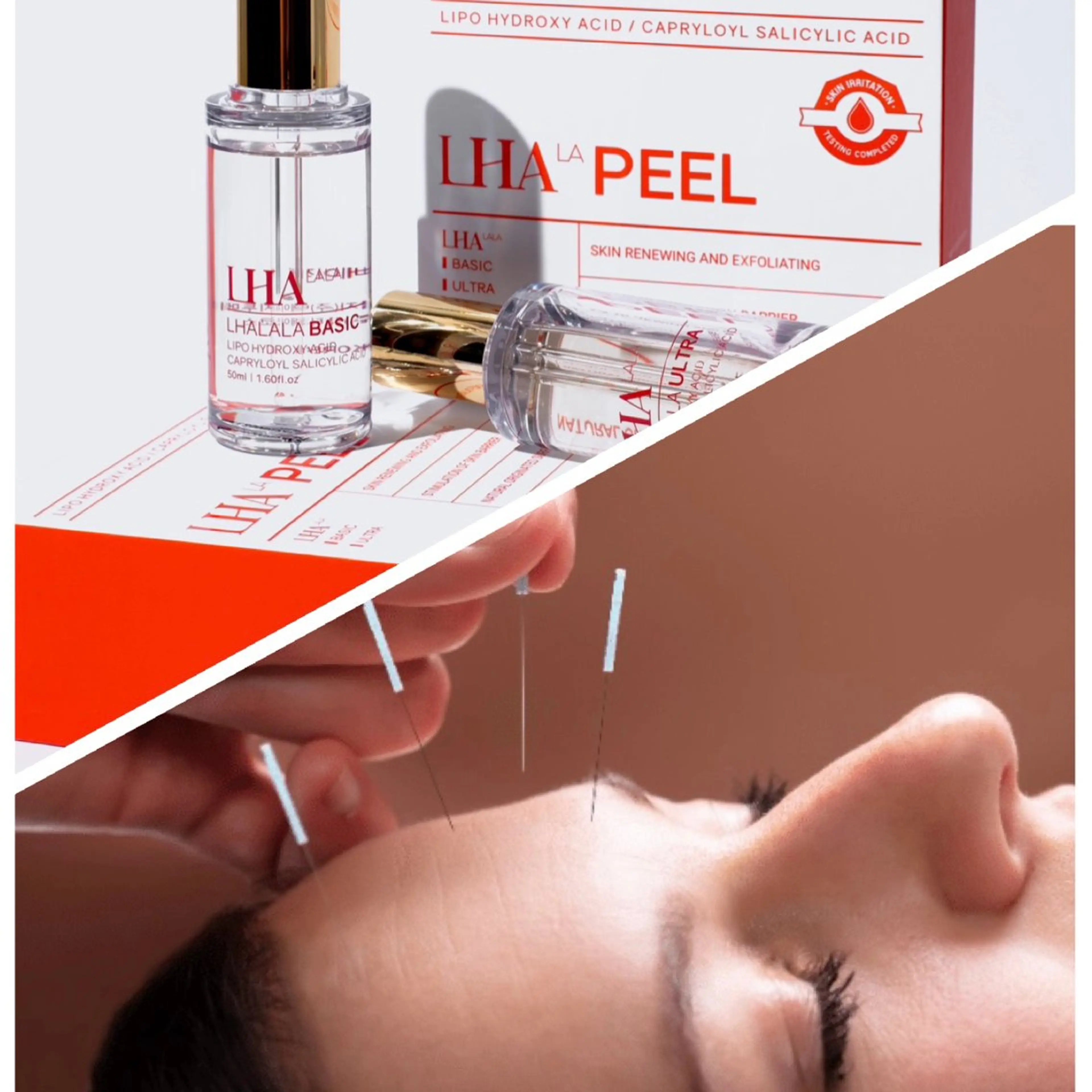 【OPEN記念⭐️人気No.1】美容鍼×ララピール90分の写真