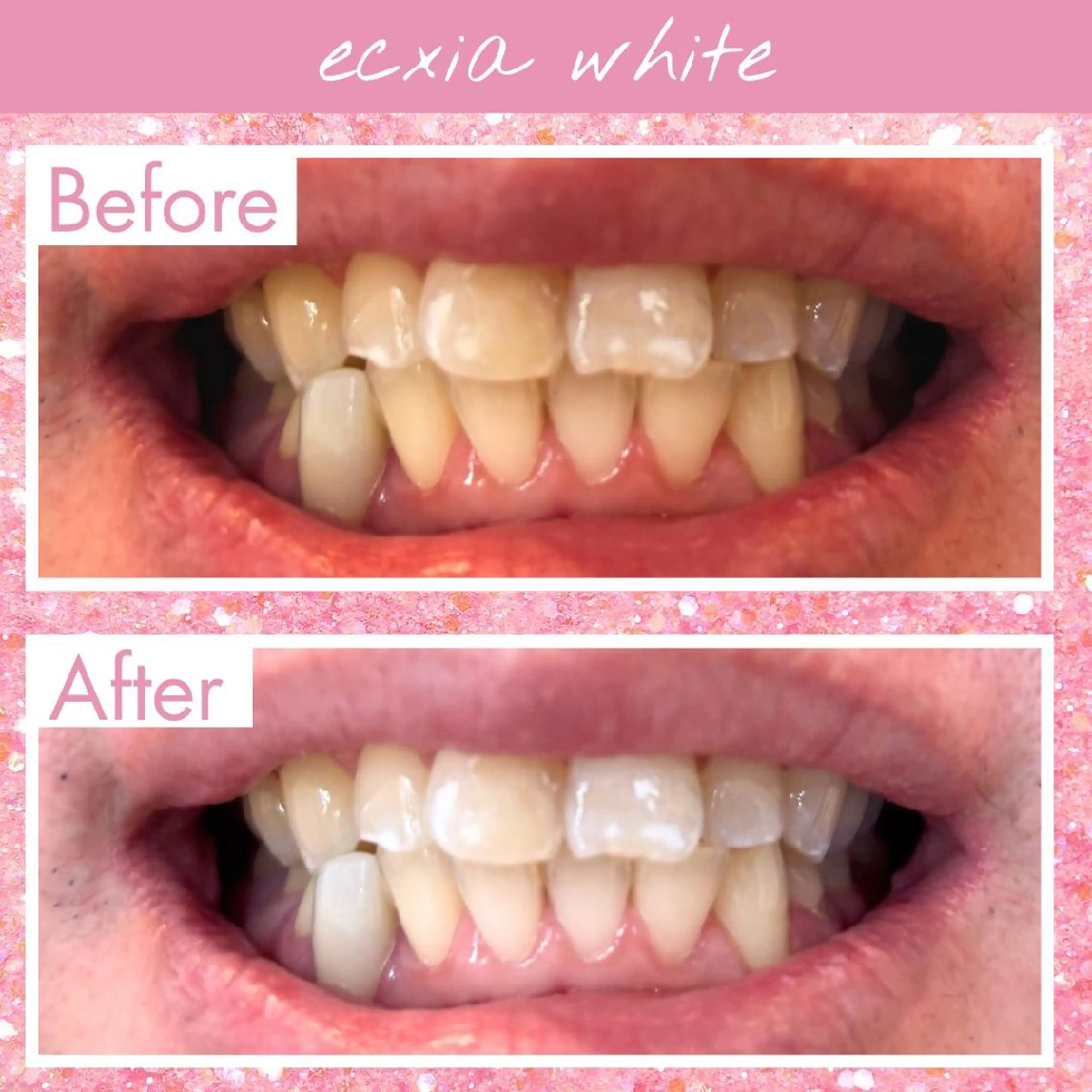 セルフホワイトニングエクシアホワイト草加店所属・セルフホワイトニング エクシア草加店のその他イメージ