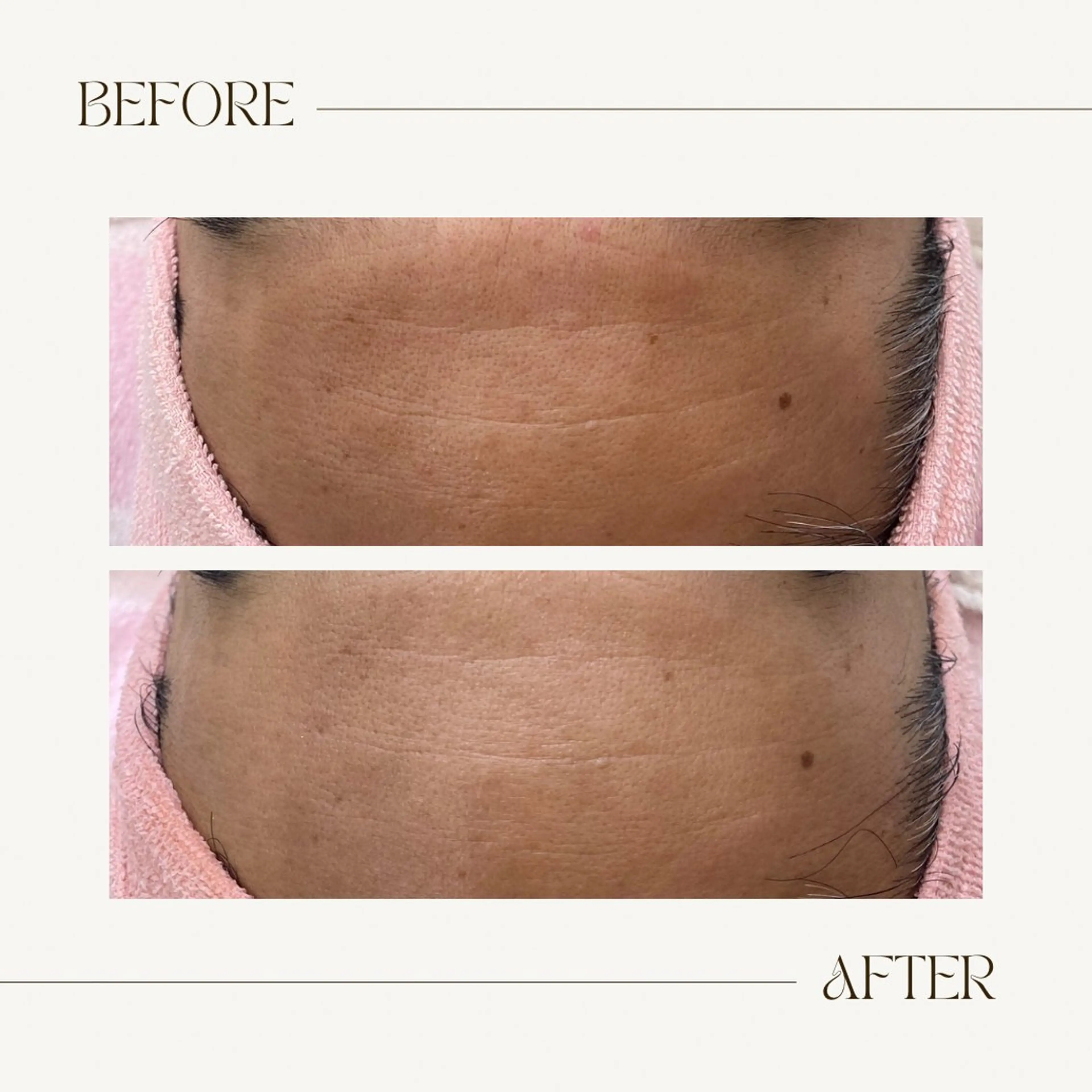 CEsalonEgg 齋藤のエステ・リラクイメージ