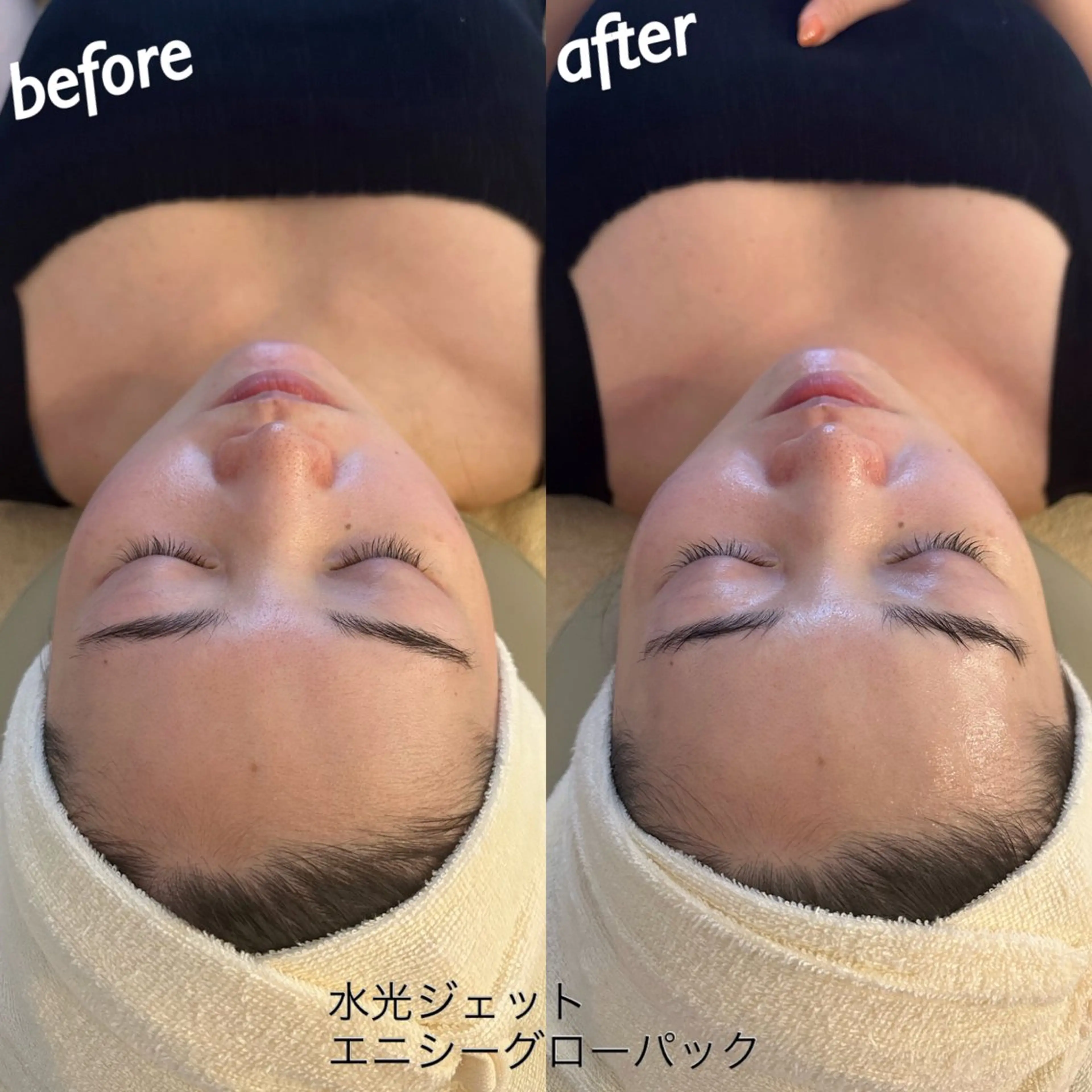 エステ うなじ脱毛/美肌脱毛 LABELのエステ・リラクイメージ