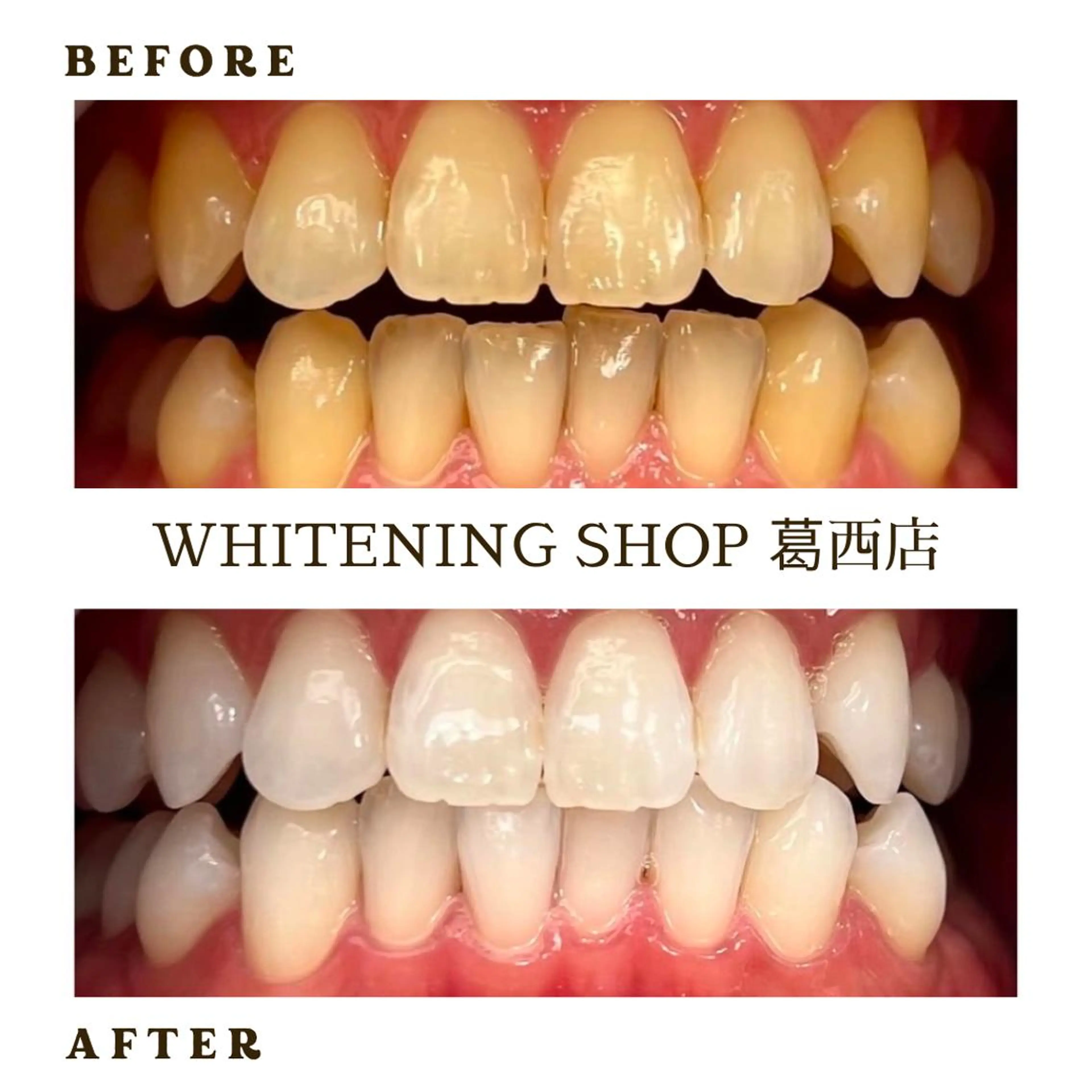 メンズ その他 ホワイトニング ショップ葛西店のその他イメージ