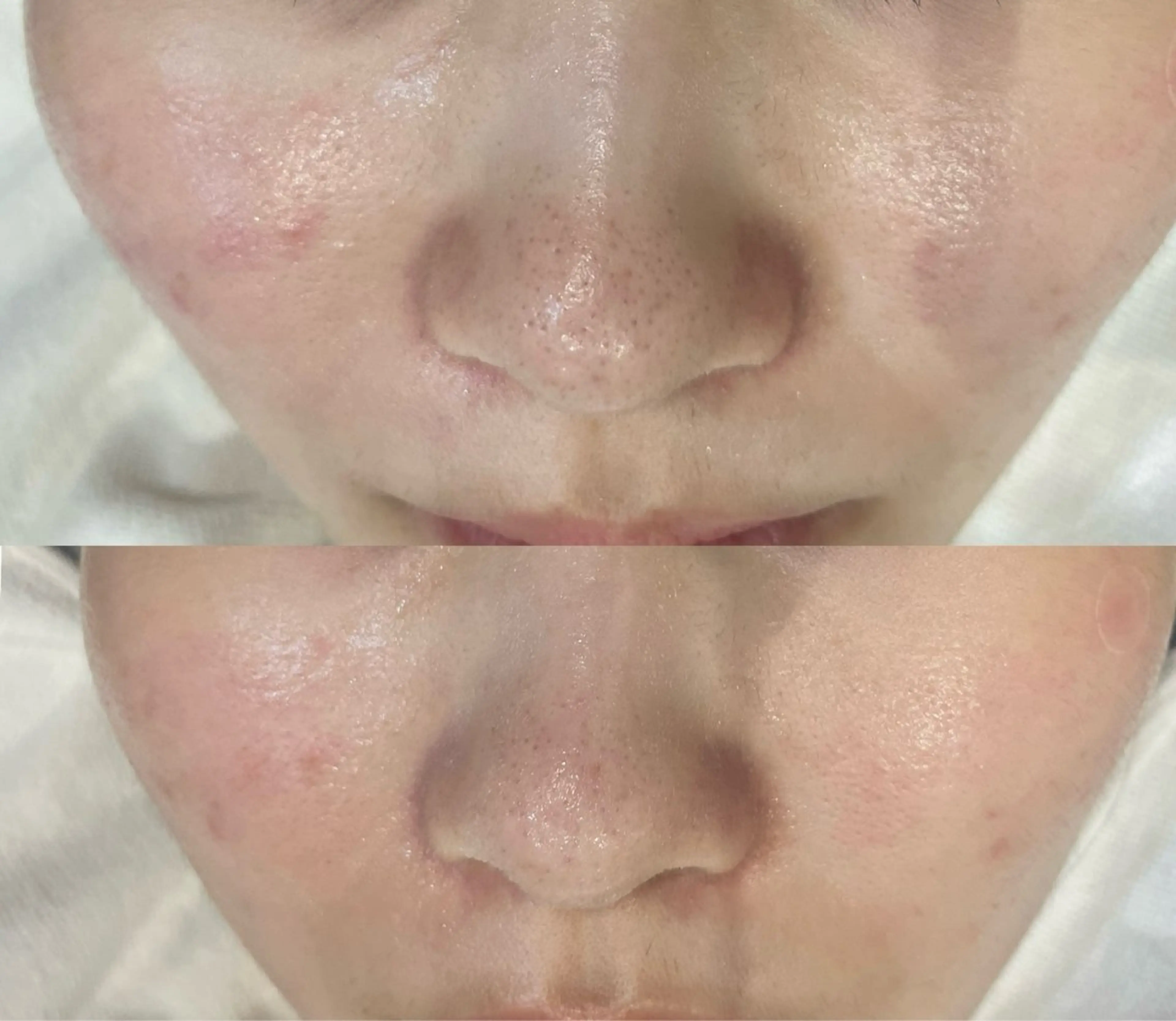 DeI'm   名古屋栄所属・小林 玲菜のエステ・リラクイメージ