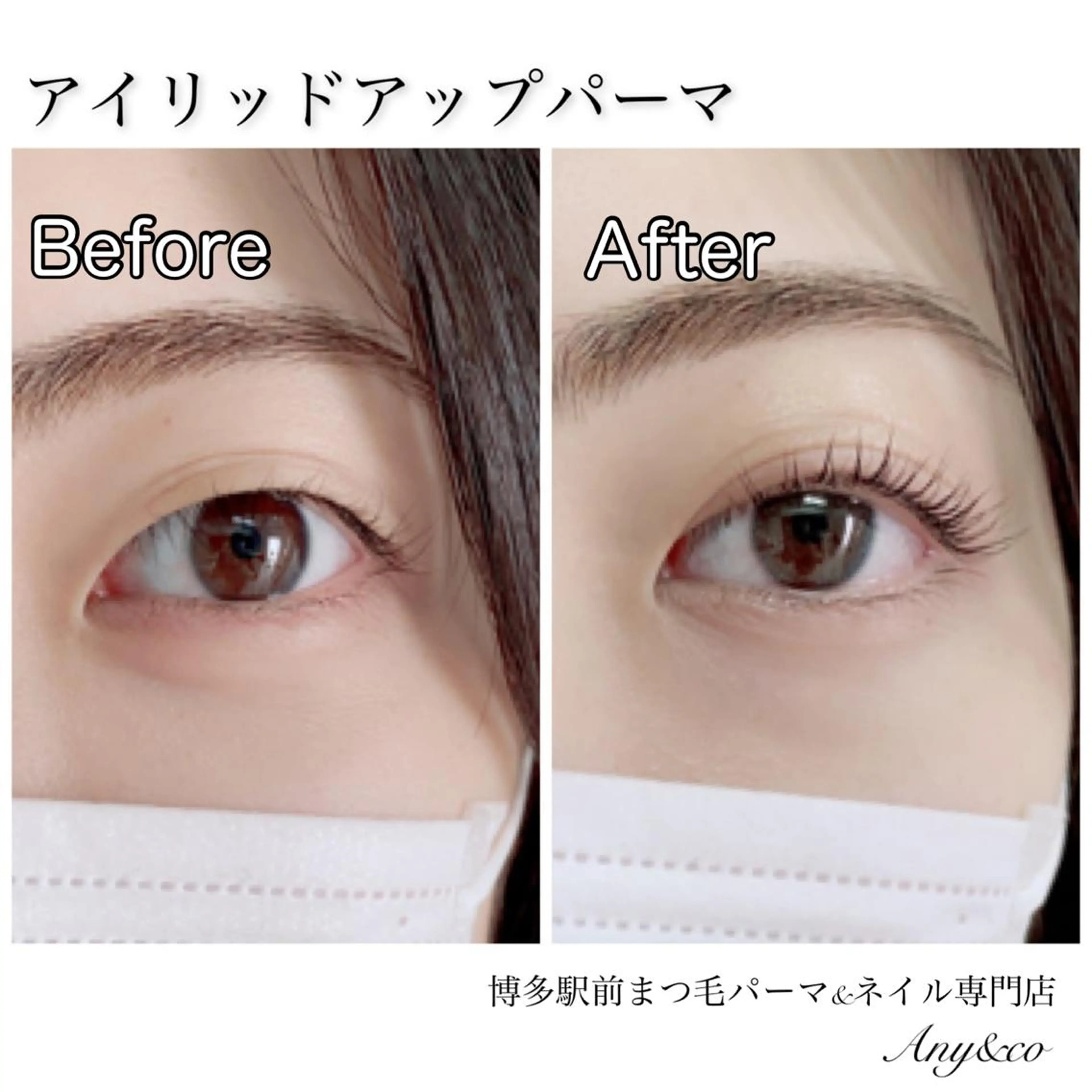 マツエク・マツパ アイリッドアップパーマ 一重×まつ毛パーマ Any&co 【エニコ】のマツエク・マツパデザイン