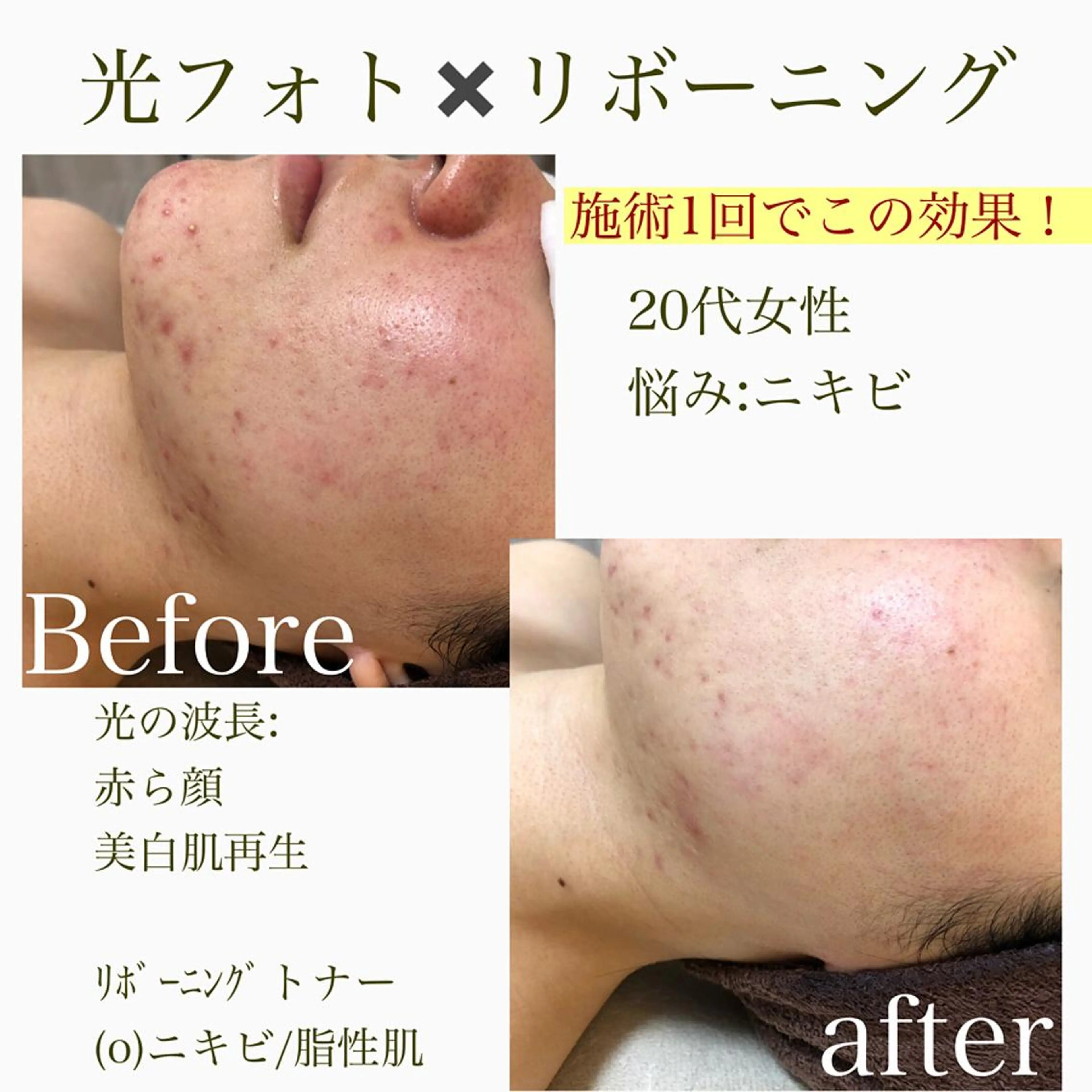 美肌脱毛と癒しのﾌﾟﾗｲﾍﾞｰﾄｻﾛﾝ。gratia~ｸﾞﾚｲﾃｨｱ~所属・gratia ~ｸﾞﾚｲﾃｨｱ~のエステ・リラクイメージ