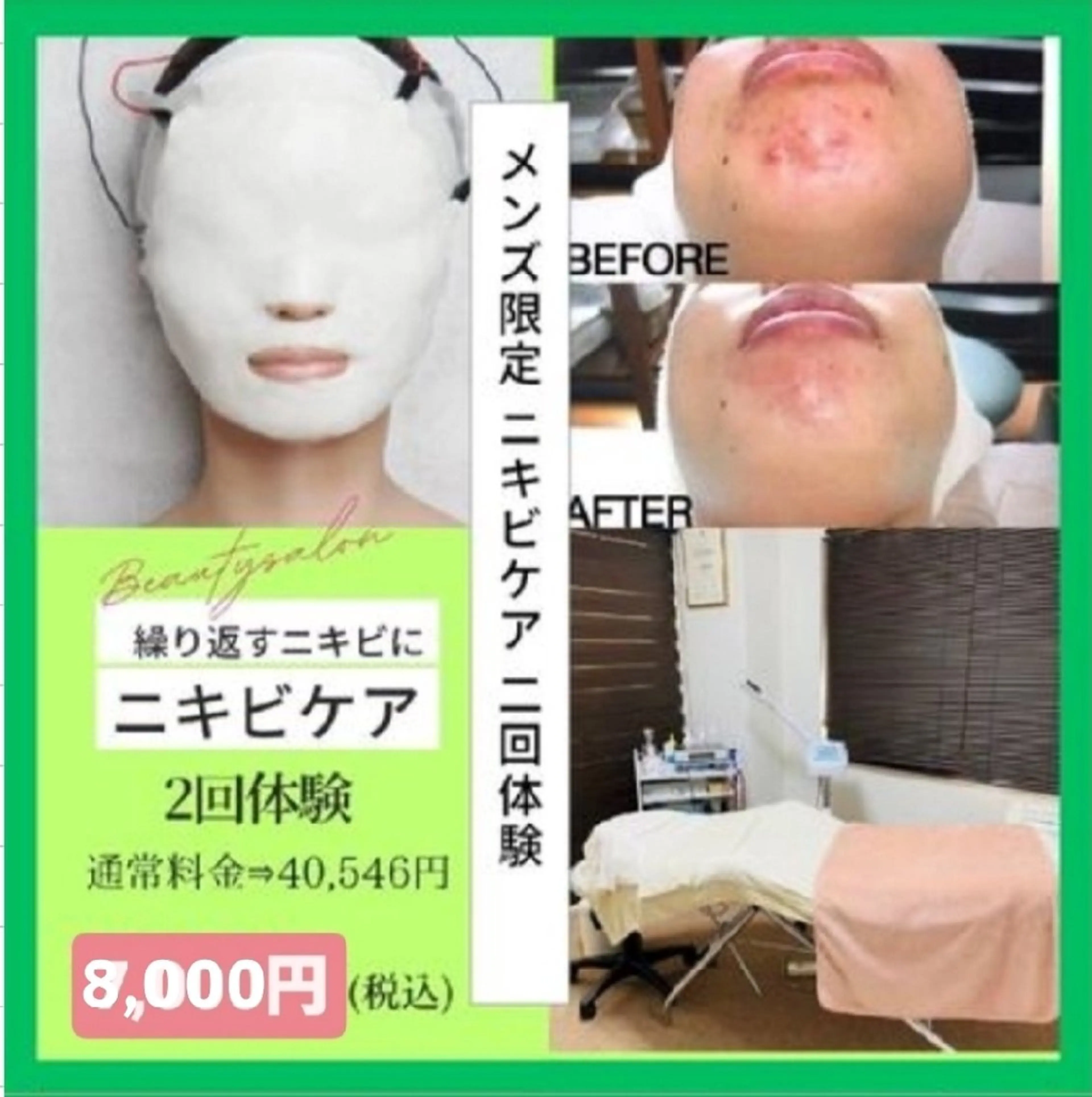 ミニモ限定✨大人気🎶💎社会人応援割💎ニキビ/ニキビ跡《メンズ限定》ニキビケア2回体験✨　[大阪城北詰駅/京橋駅]の写真