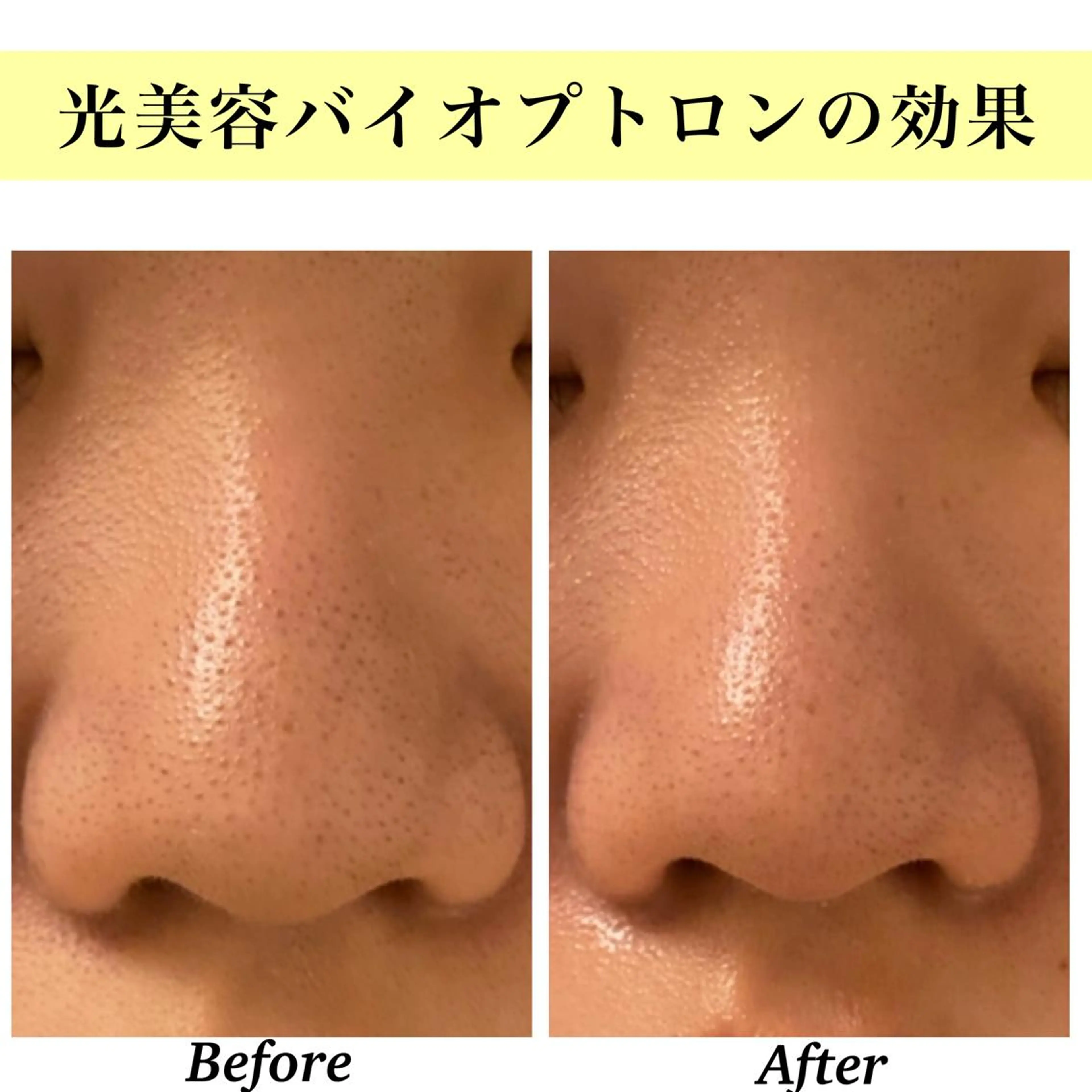 Bellesthe （ベルエステ）のエステ・リラクイメージ