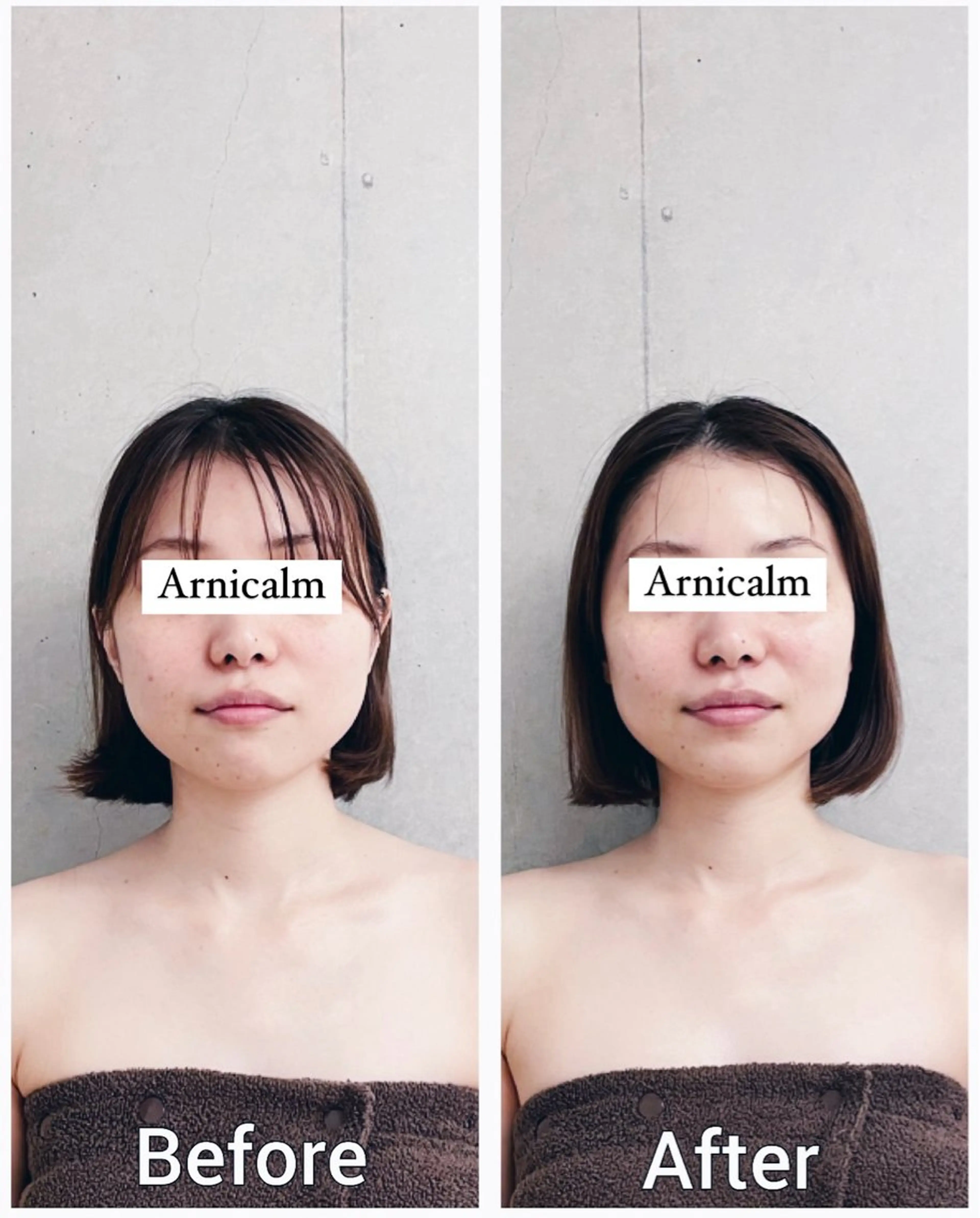 エステ ハーブピーリング 肌再生ピーリング/のエステ・リラクイメージ