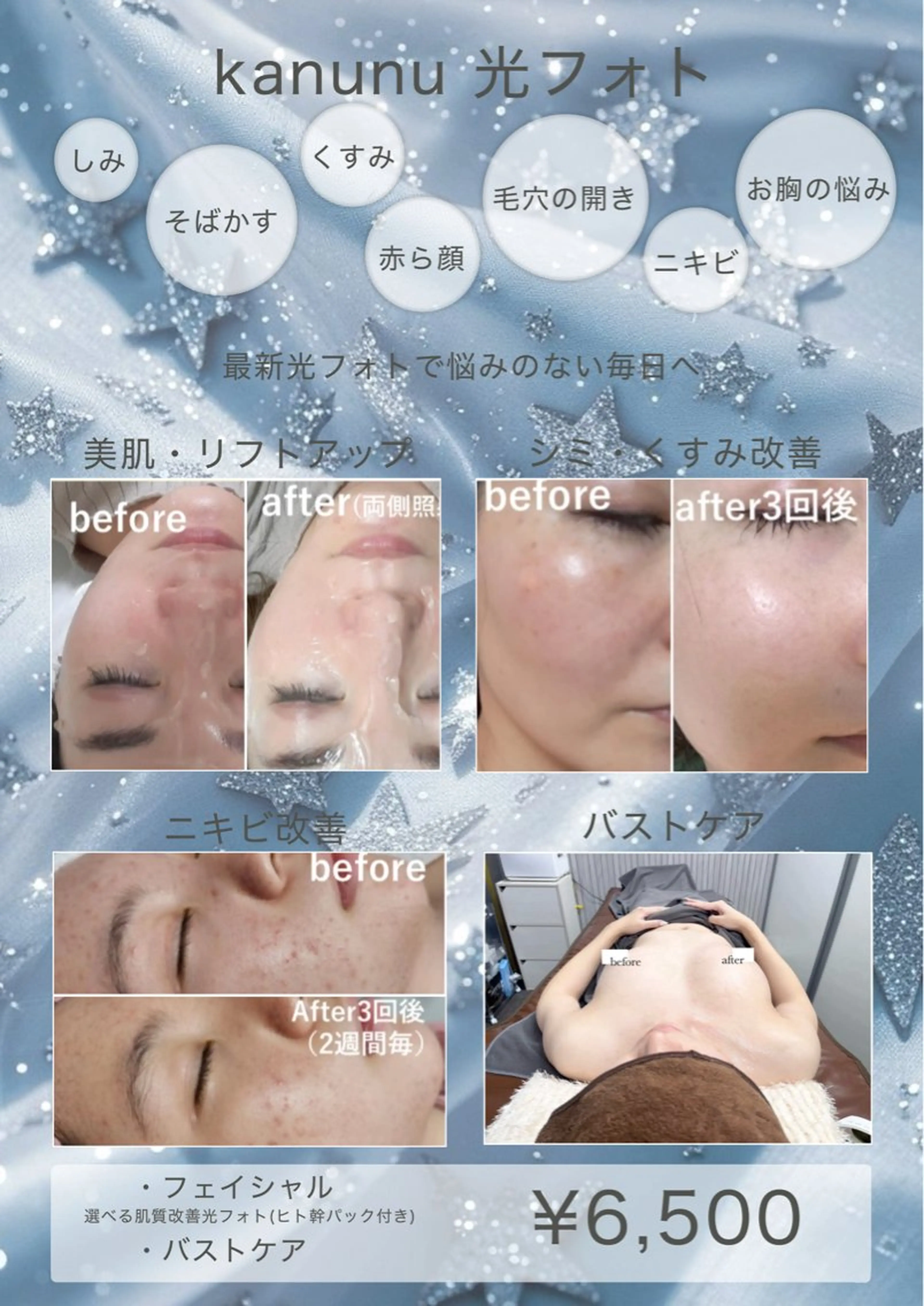 Kanunu所属・鶴橋エステ kanunuのエステ・リラクイメージ