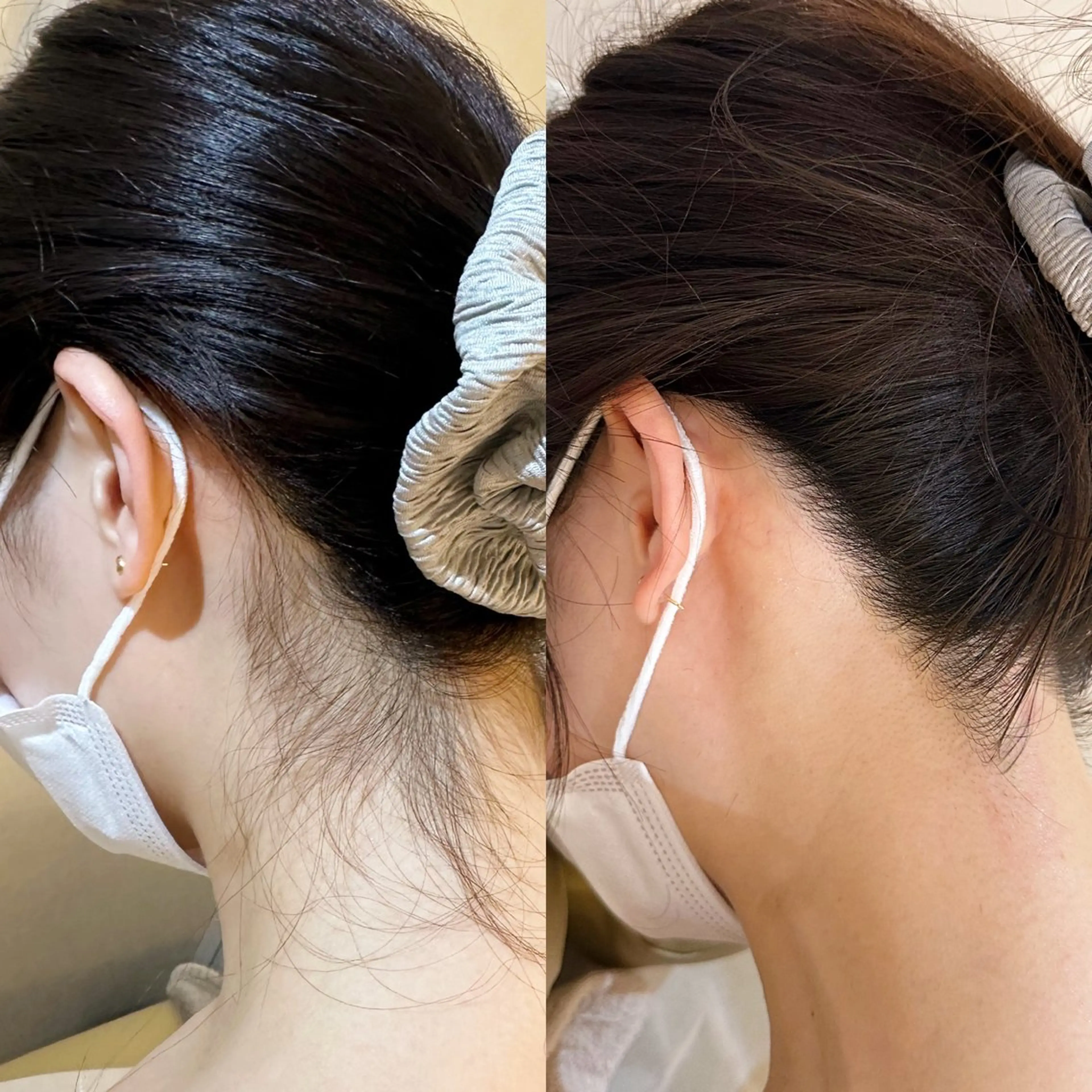 脱毛 うなじ脱毛/美肌脱毛 LABELのエステ・リラクイメージ