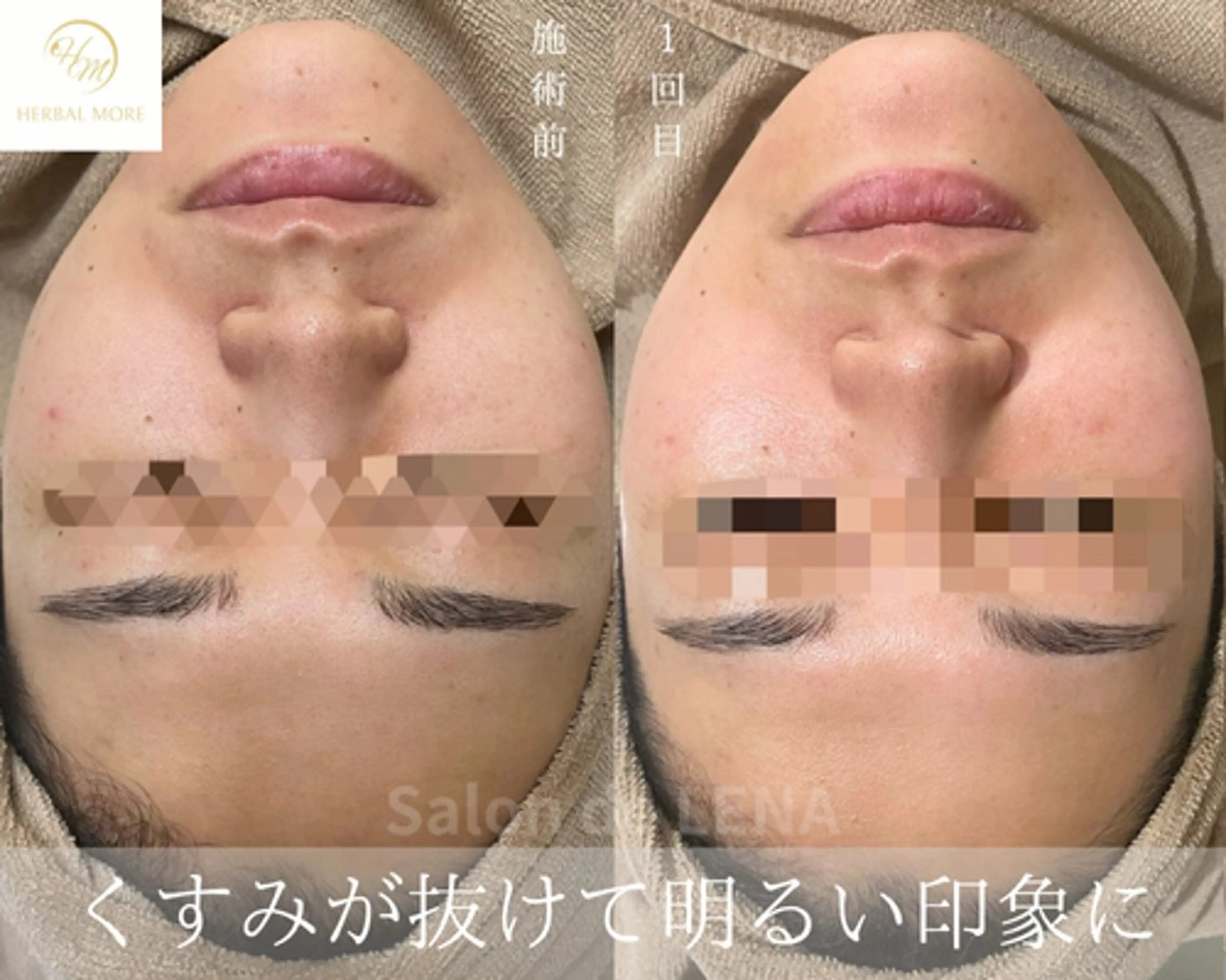 ハーブピーリング・毛穴ケア専門サロンSalon de LENA 栄店所属・ハーブピーリング専門 サロンドレナ　白藤のエステ・リラクイメージ