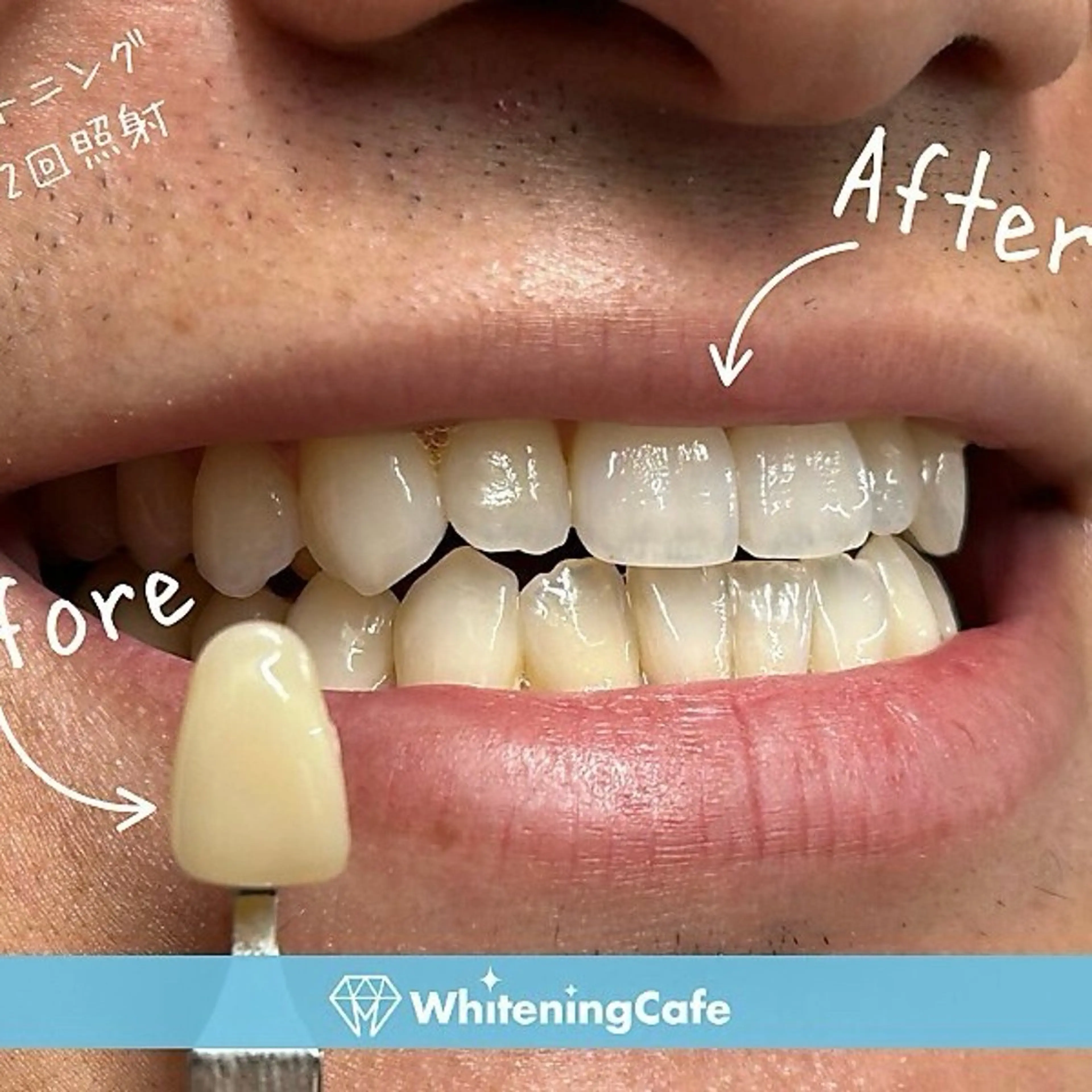 ホワイトニングカフェ神戸元町店所属・ホワイトニングカフェ 神戸元町店のエステ・リラクイメージ