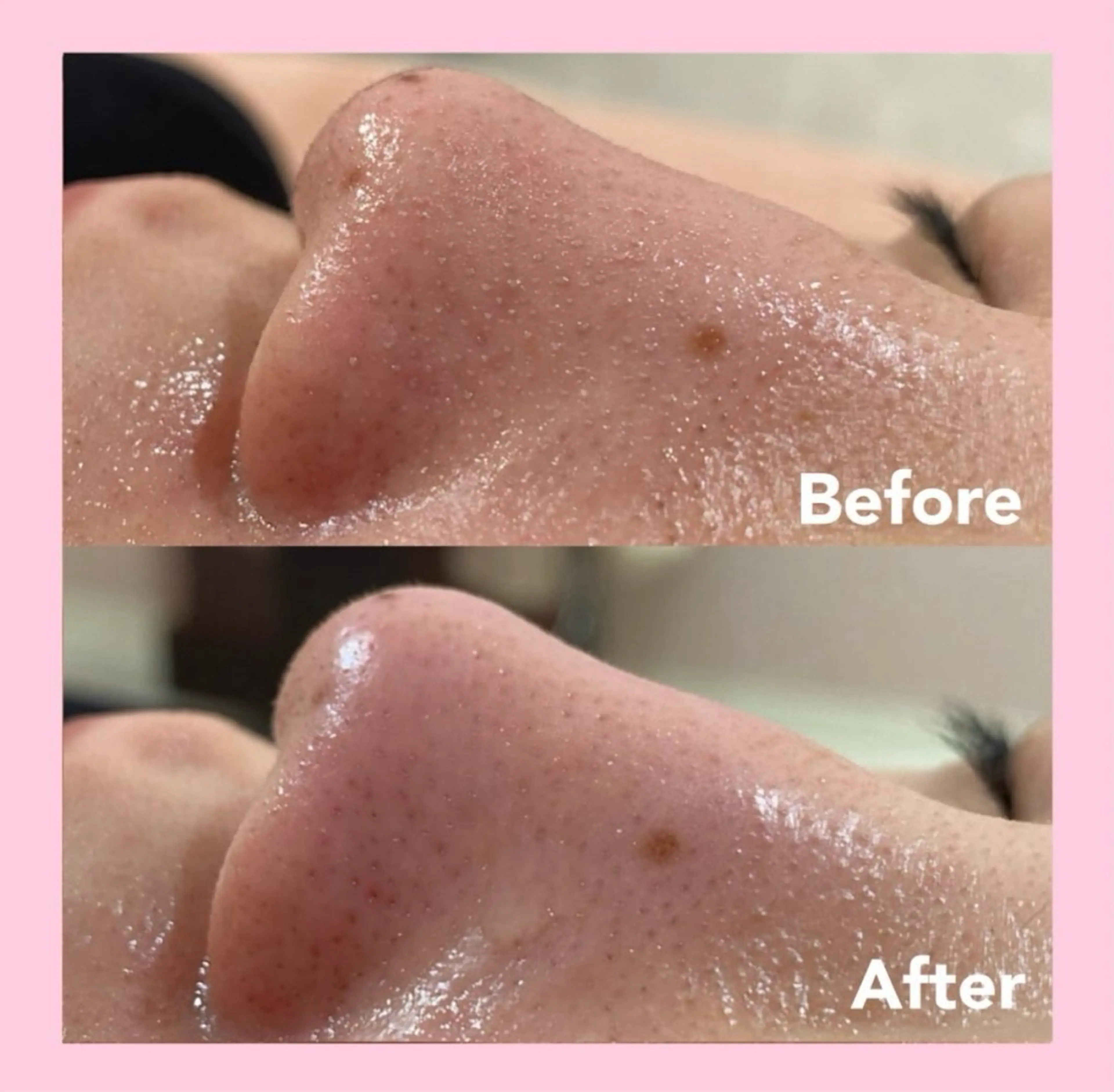 エステ 韓国肌管理専門店　White labo 宝塚店所属・有川 凜のエステ・リラクイメージ