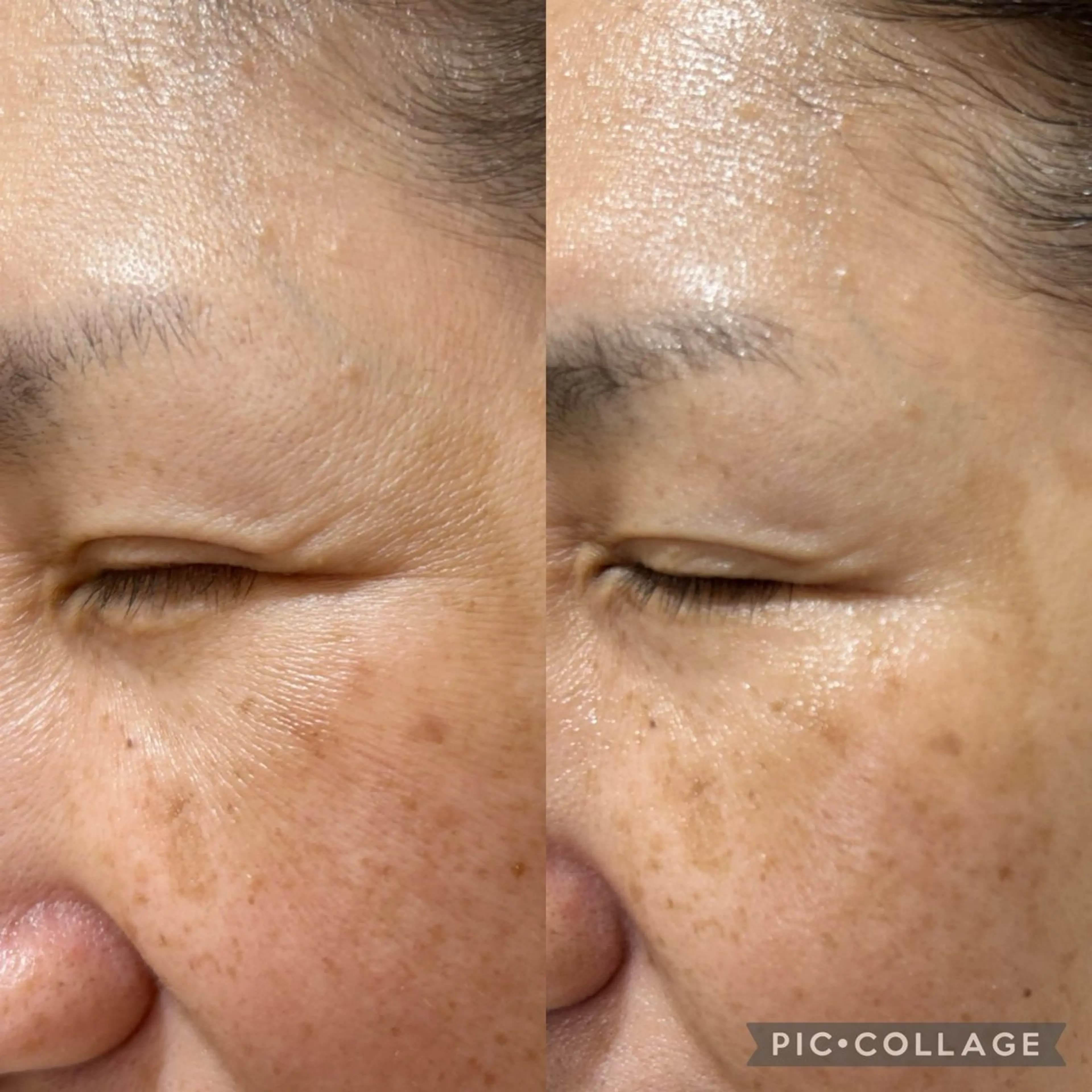 DeI'm柴田所属・【肌質改善サロン】 Harunaのネイルデザイン