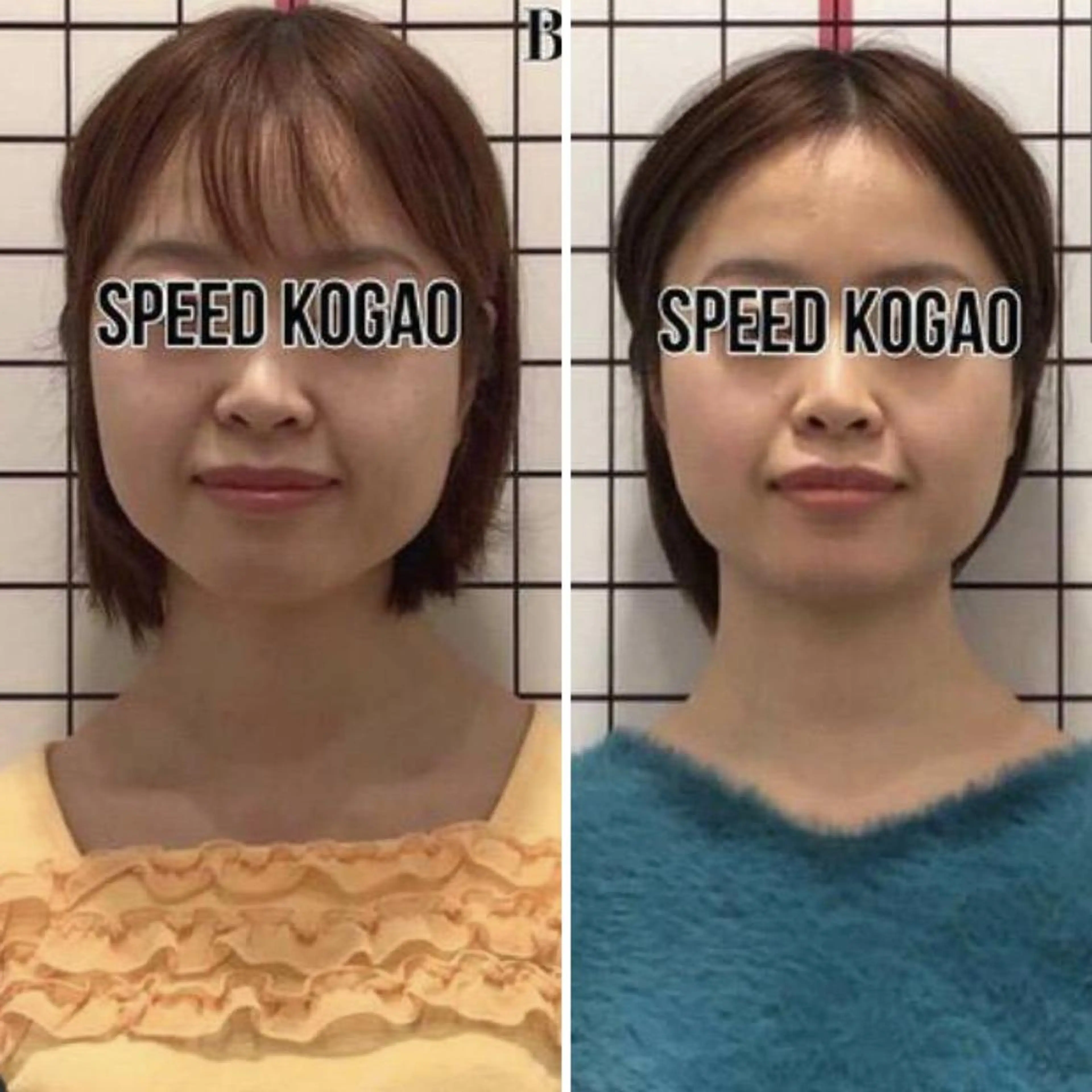 小顔矯正 natsuのエステ・リラクイメージ