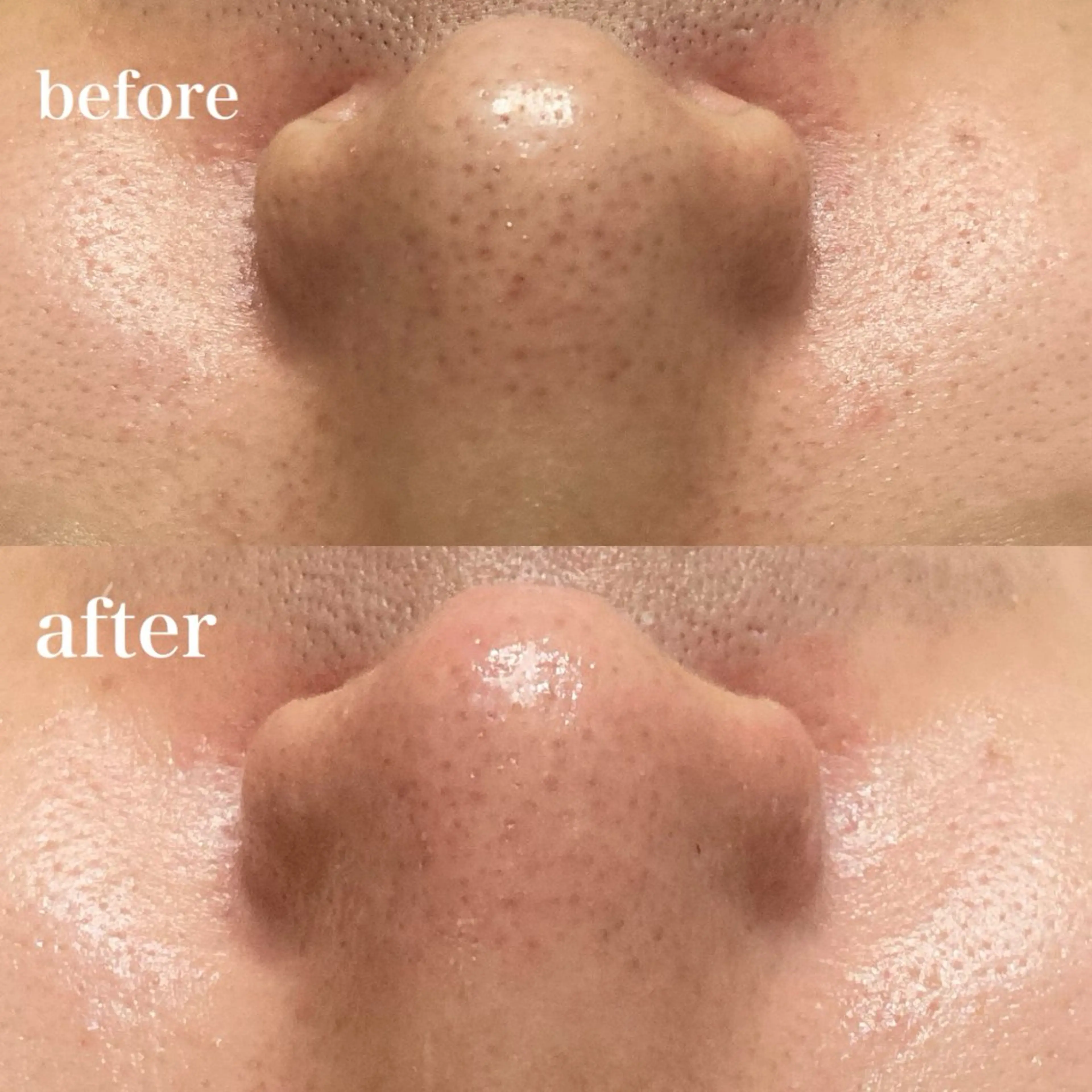 磐田｜LAYLA 一番丁寧な脱毛店のエステ・リラクイメージ