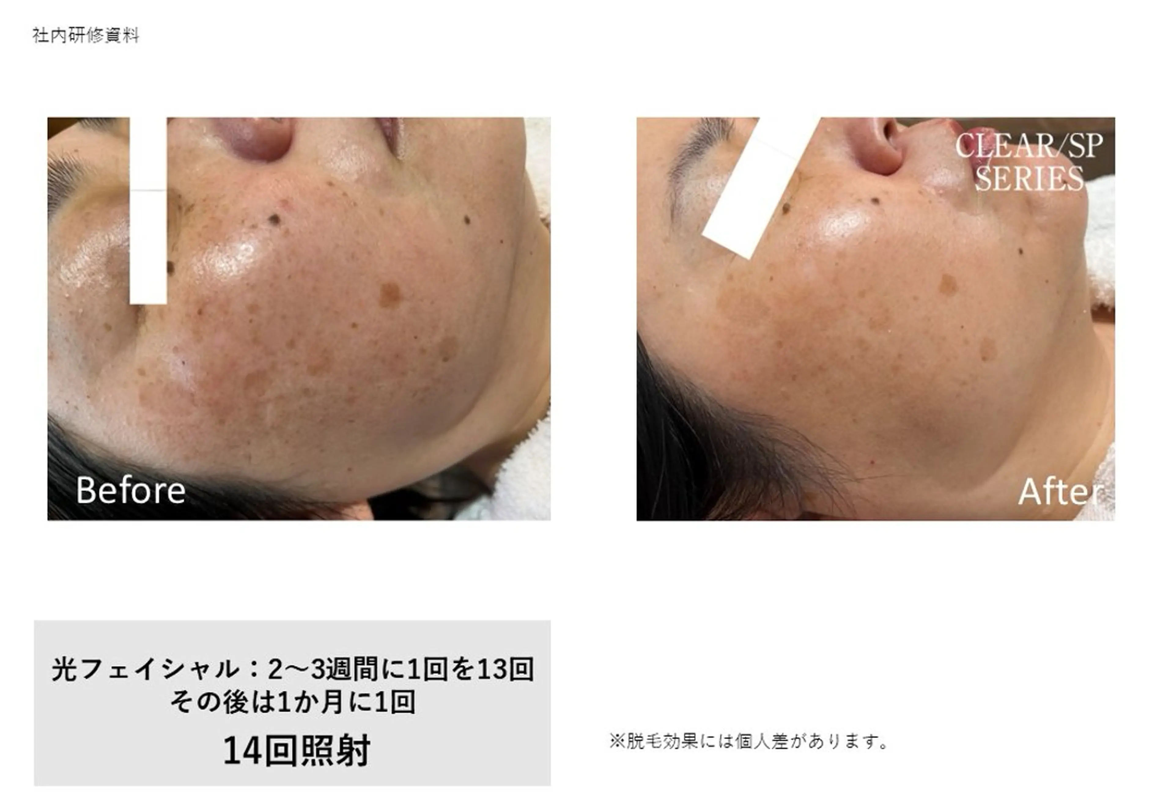 エステ LeCoeur喜多町 松本のエステ・リラクイメージ