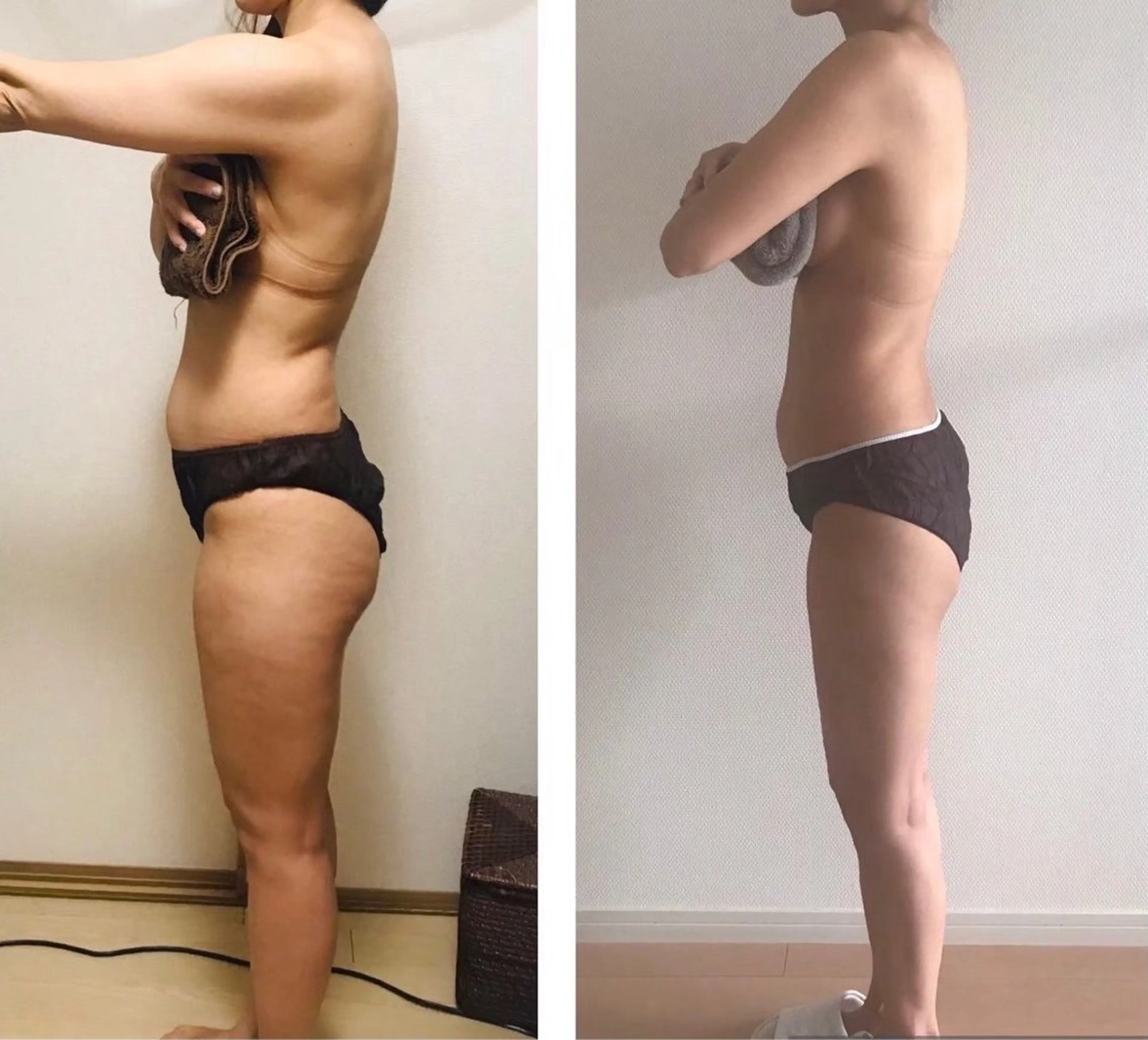 エステ リラク 痩せるハーブ蒸し／ 温活サロン imuaのエステ・リラクイメージ