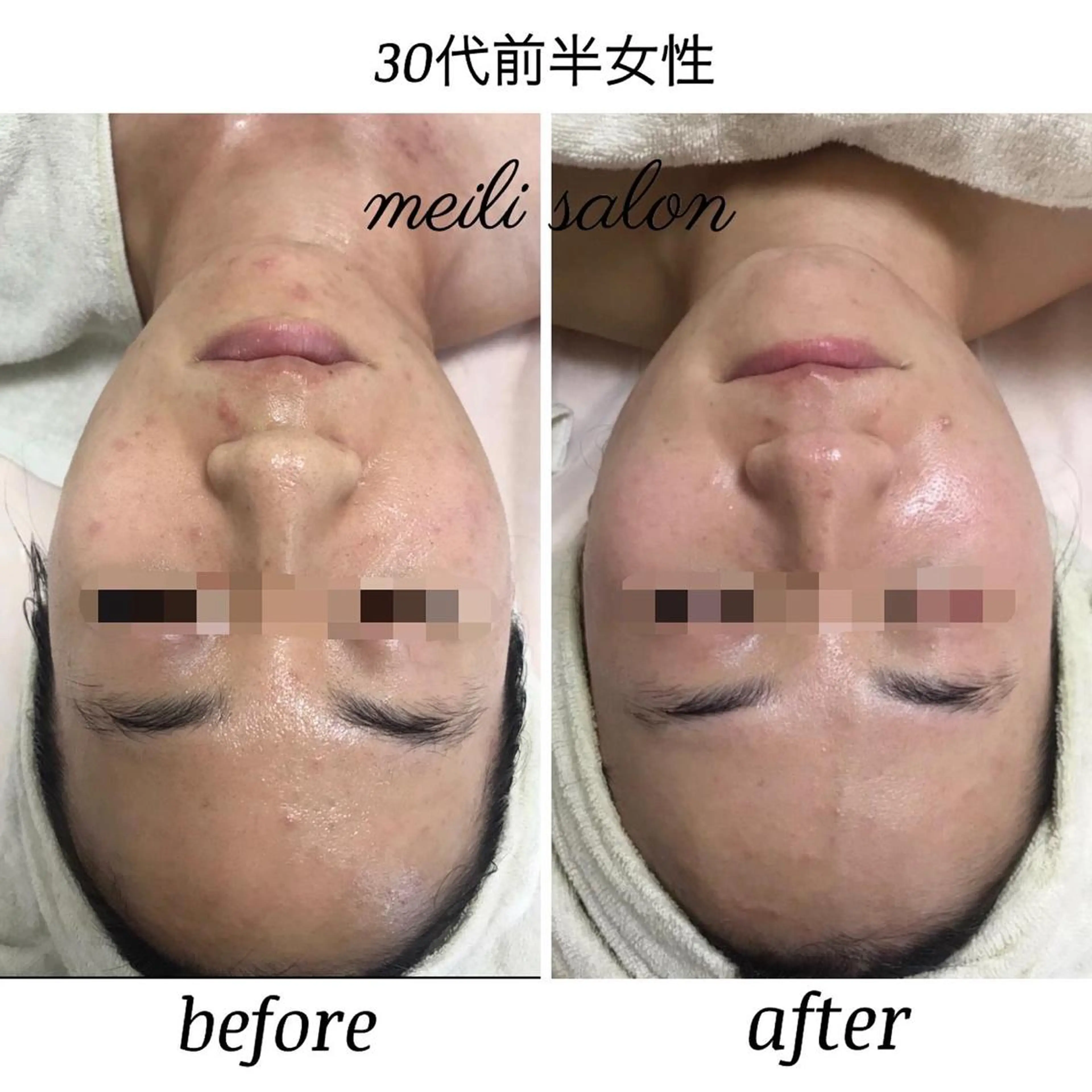 モニター様限定破格🙋♀️✨マッサージ+光フェイシャル✨の写真