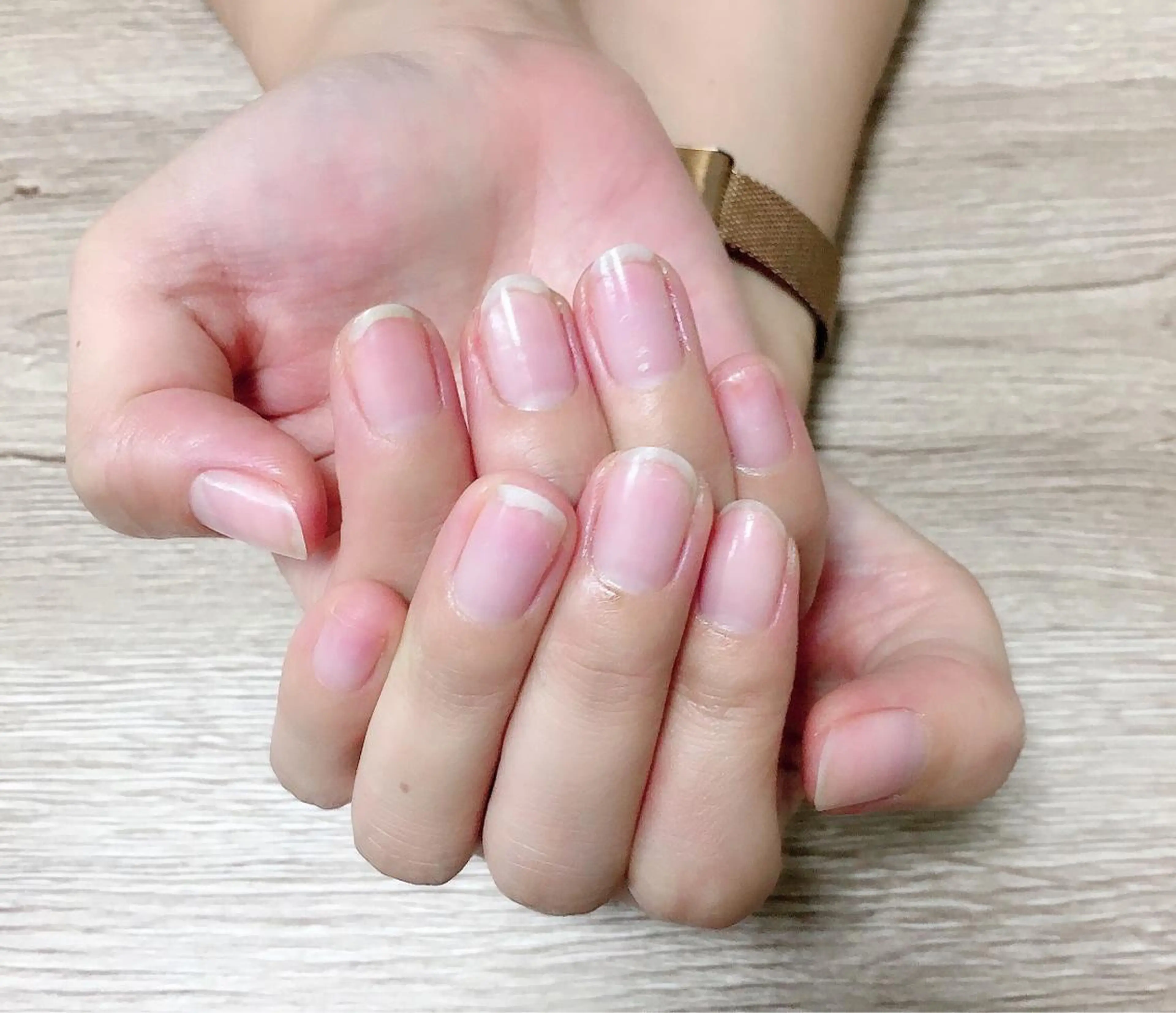 ネイル ジェルネイル 自爪育成/深爪矯正 mikiのネイルデザイン